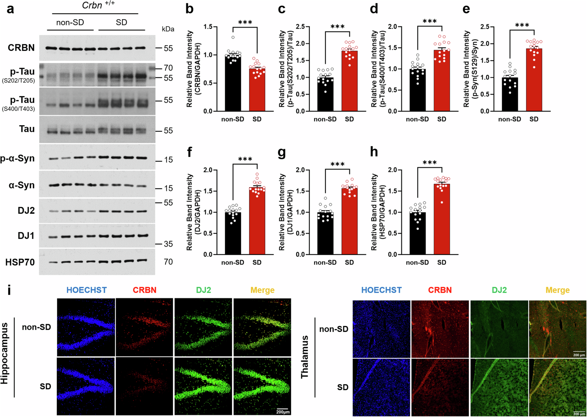 cerebrolysin epitalon bpd-157 ghk-cu lgd-4033 ostarine and mk-677 Enhanced homeostatic sleep response decreased neurodegenerative proteins in cereblon knock-out mice biodegradable diapers