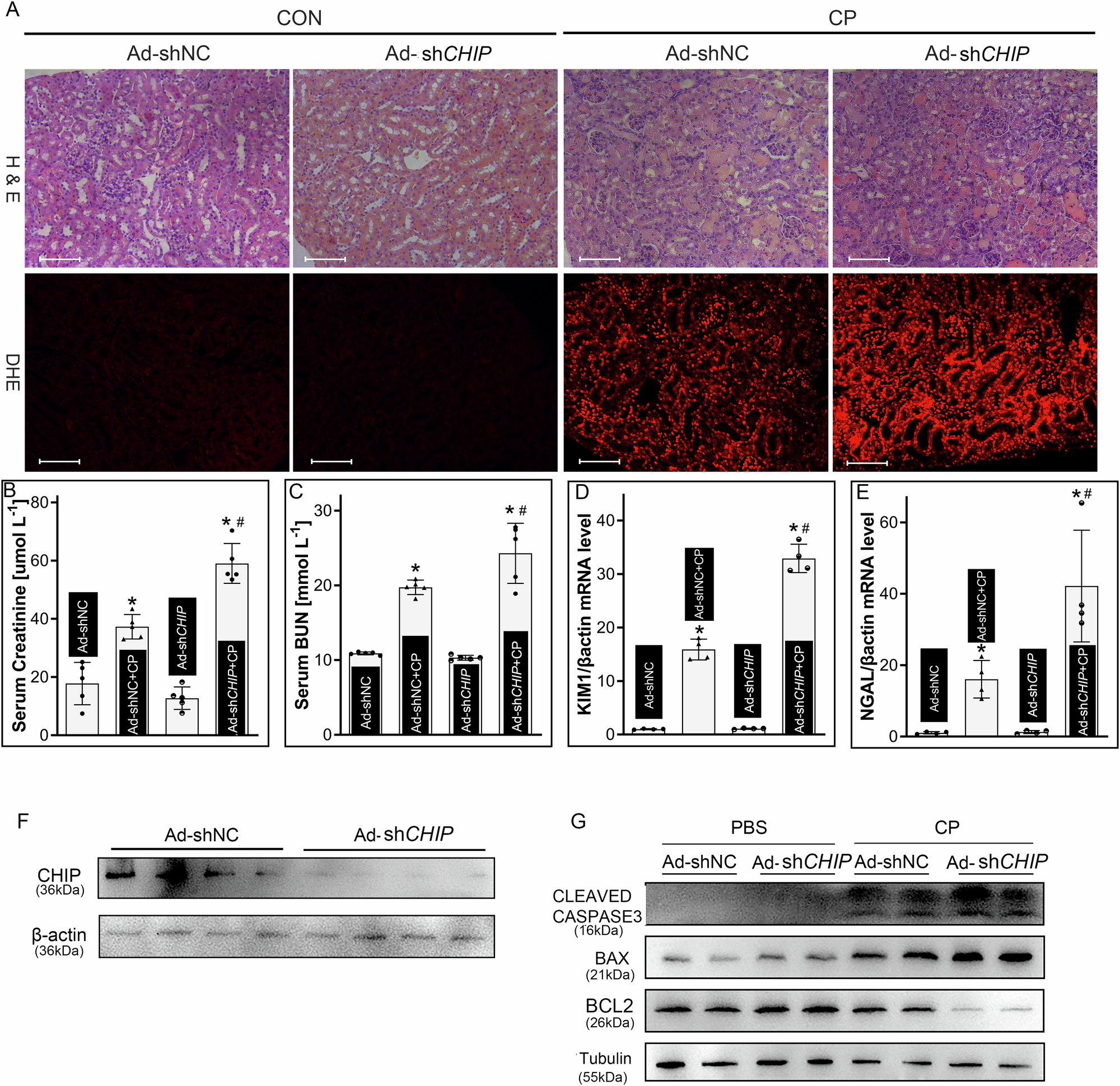 Fig. 5: CHIP knockdown accentuated cisplatin-induced AKI.