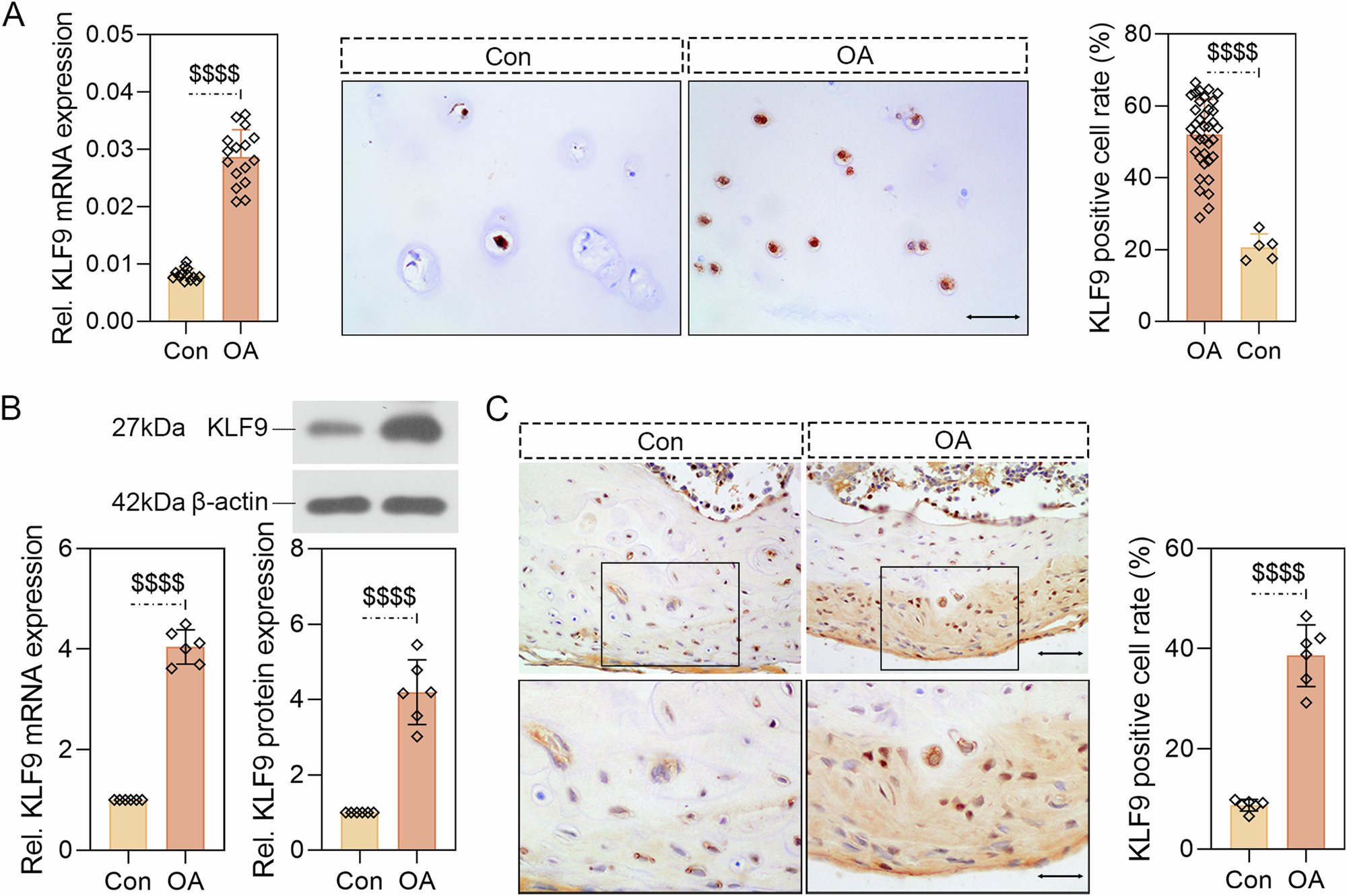 Fig. 2: The expression of KLF9 was significantly upregulated in OA human and rat articular cartilage tissues.