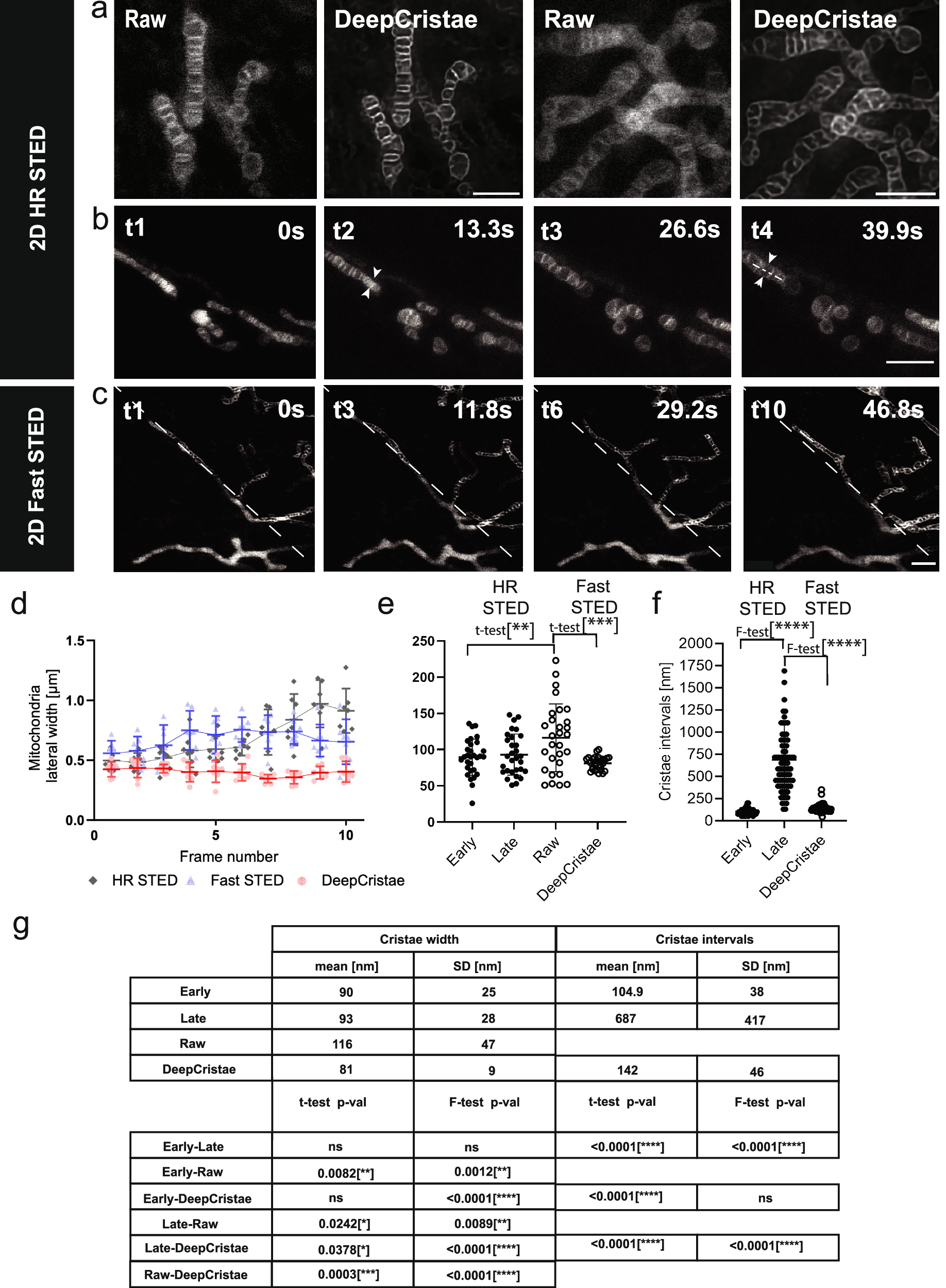 Fig. 6: DeepCristae reveals mitochondria cristae from low resolution 2D live STED.