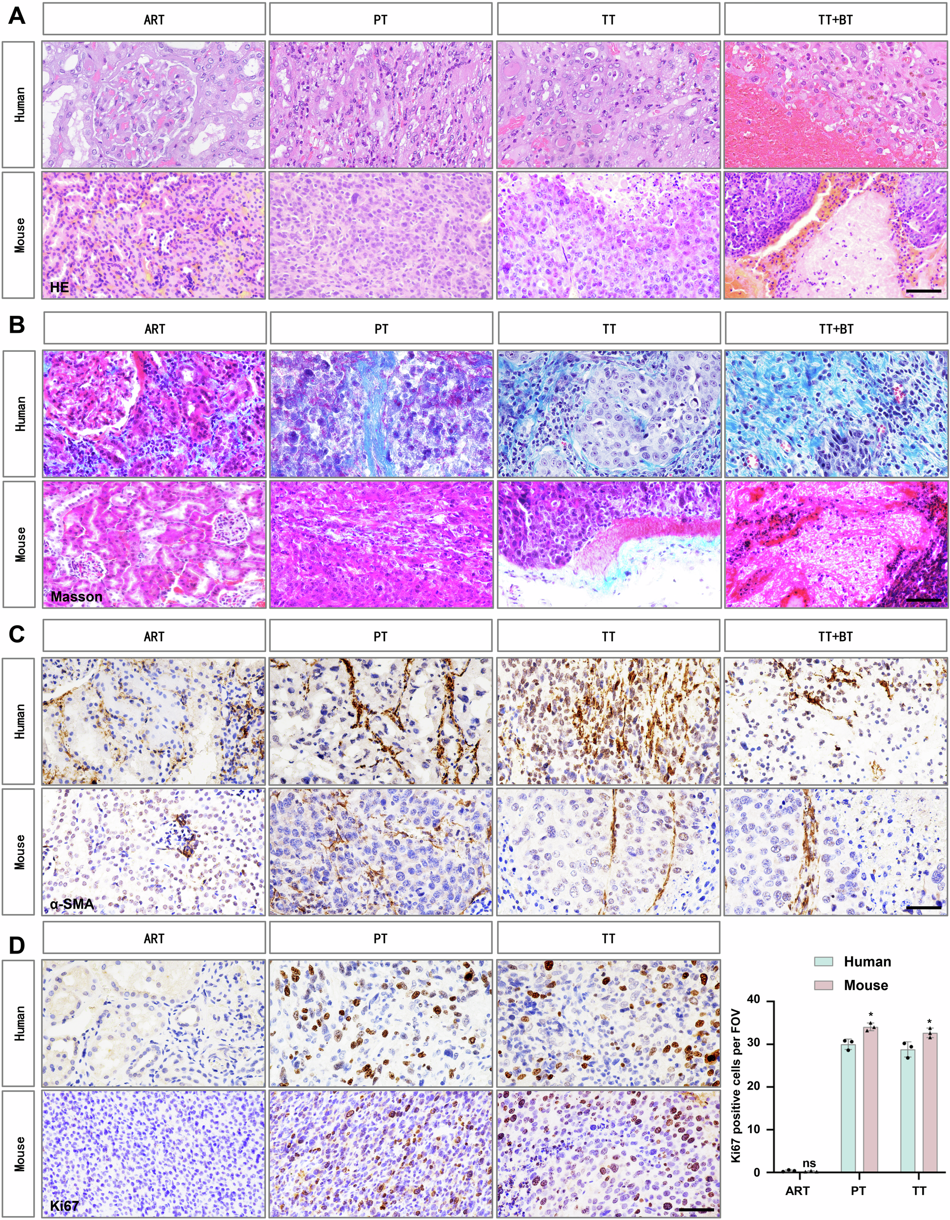 Fig. 3: TT in immunocompetent mice have similar pathological features to those in humans.
