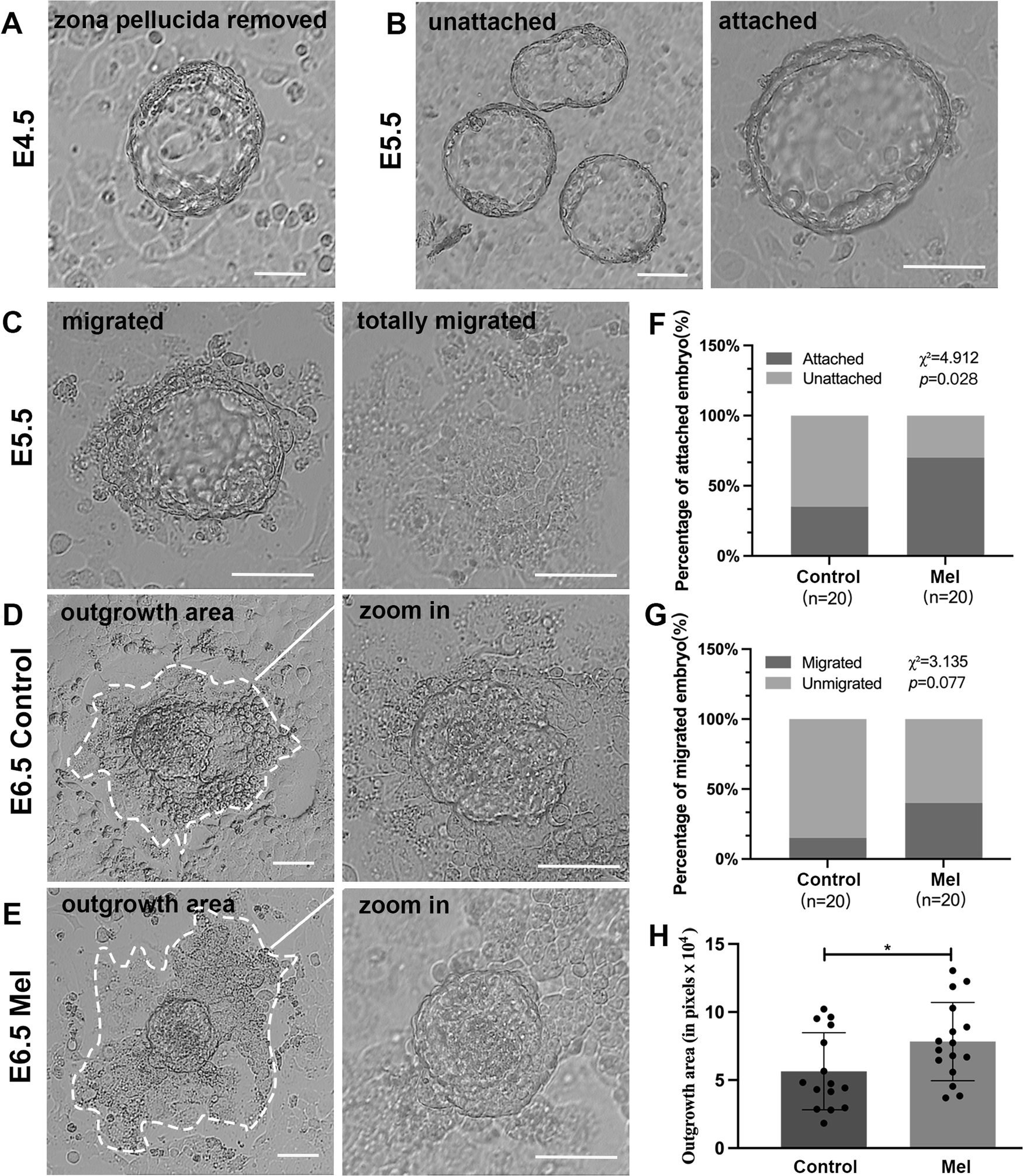 Fig. 2: Mouse embryo implantation and trophoblast cell migration were promoted after melatonin treatment in vitro.