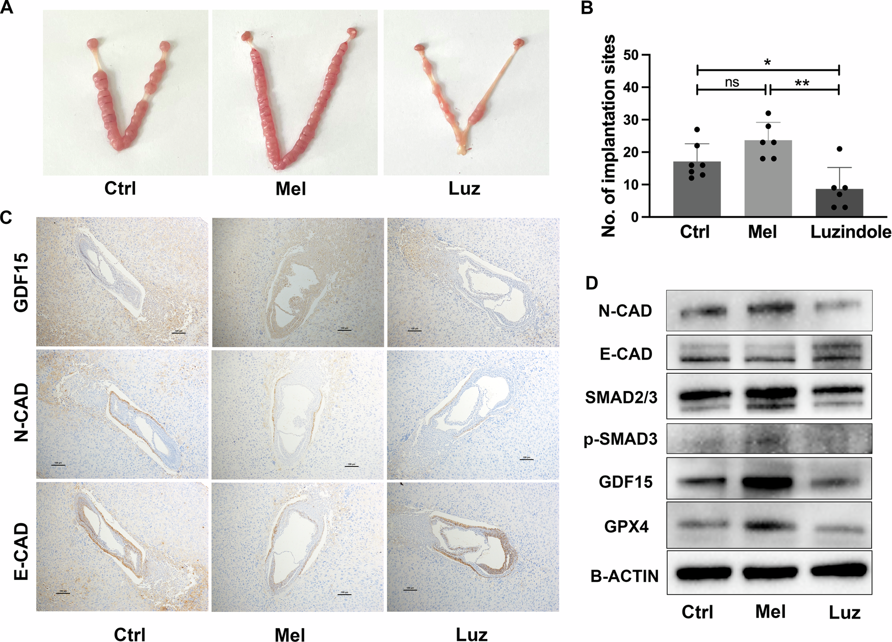 Fig. 8: The mouse in vivo embryo implantation model was used to explore the involvement of GDF15 pathway in the regulation of embryo implantation by melatonin.