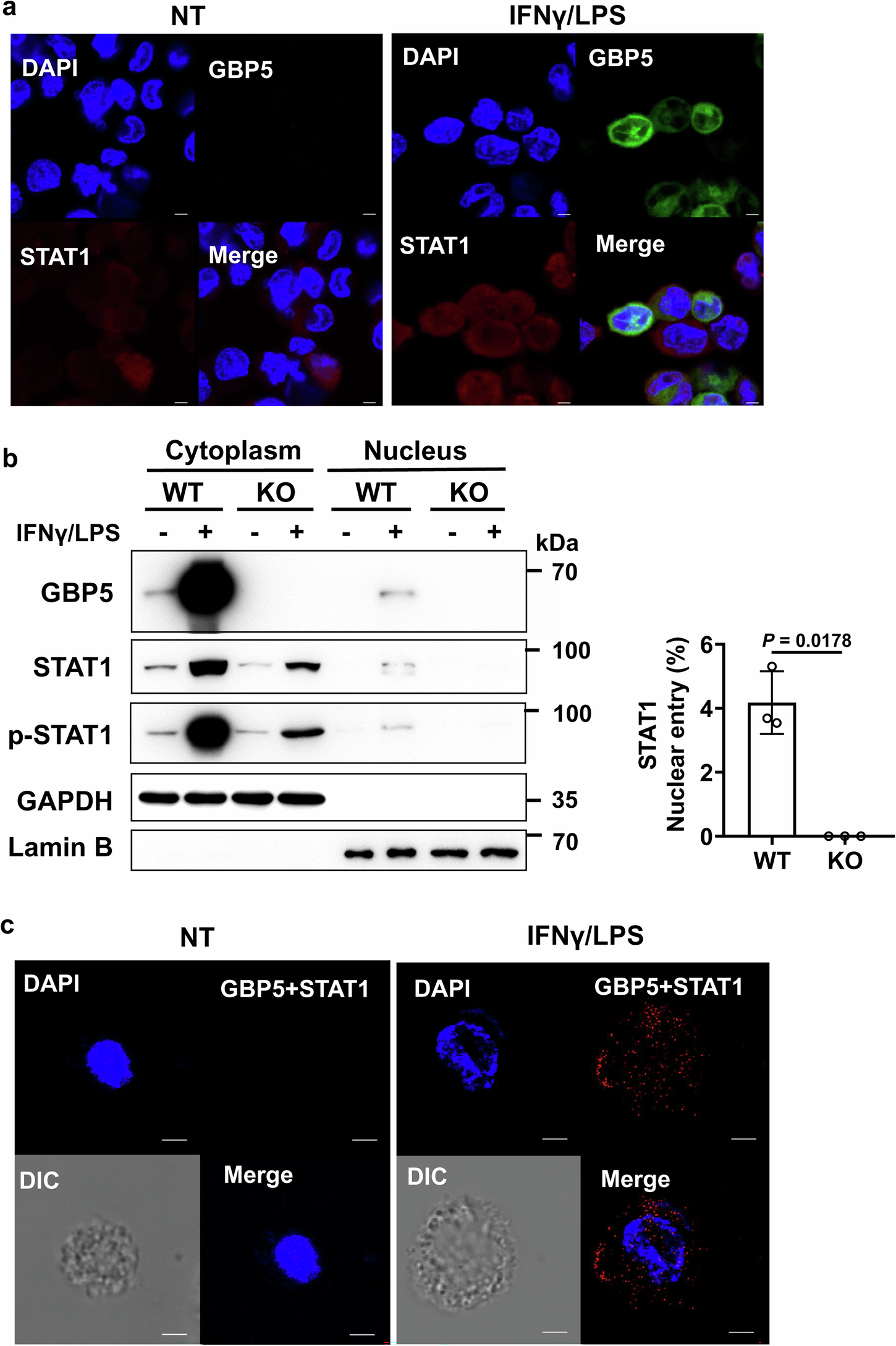 Fig. 6: Binding of GBP5 to STAT1 promotes the nuclear translocation of STAT1.