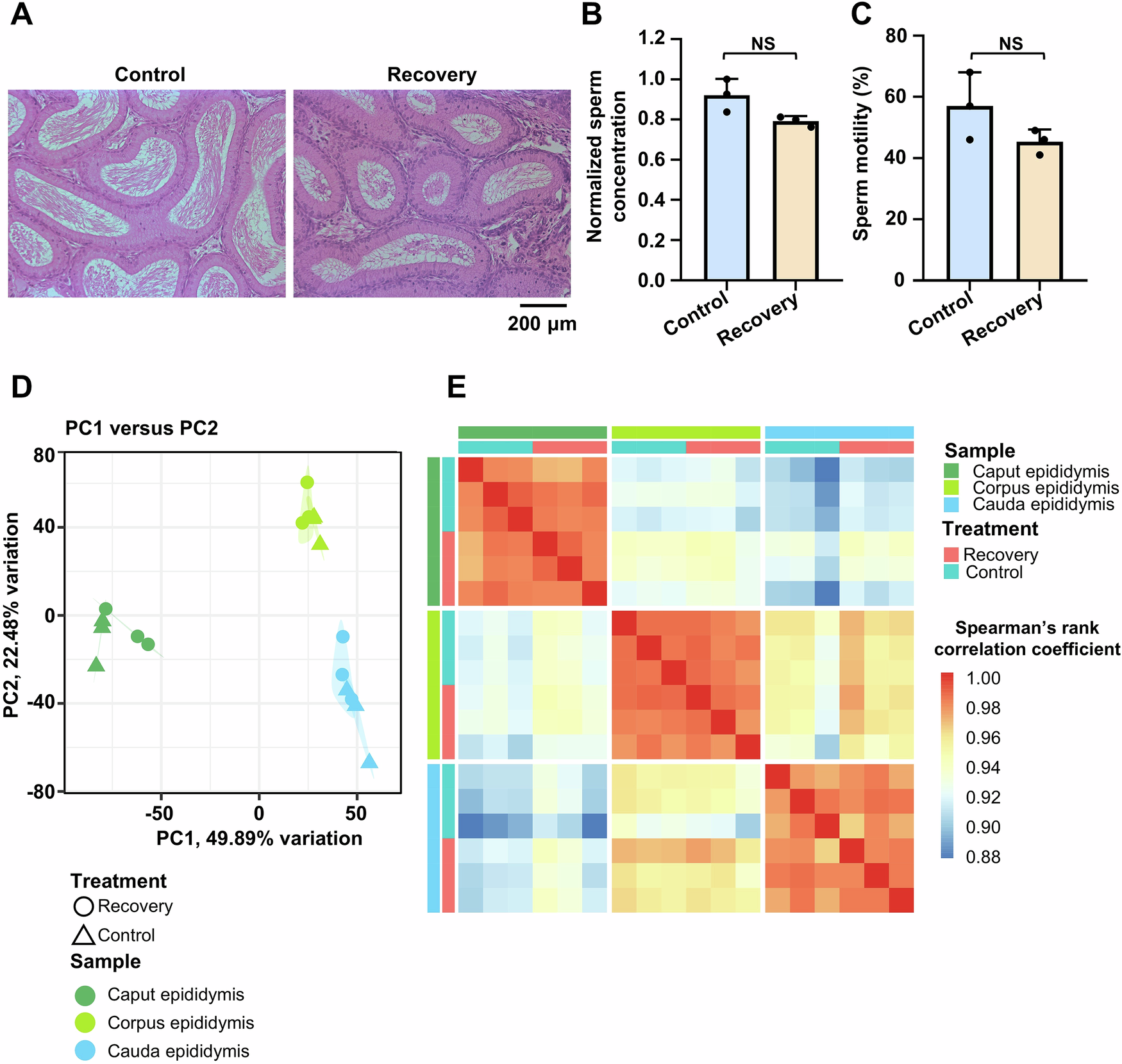 Fig. 8: Recovery sleep reduces sleep deprivation (SD)-induced male reproductive issues.
