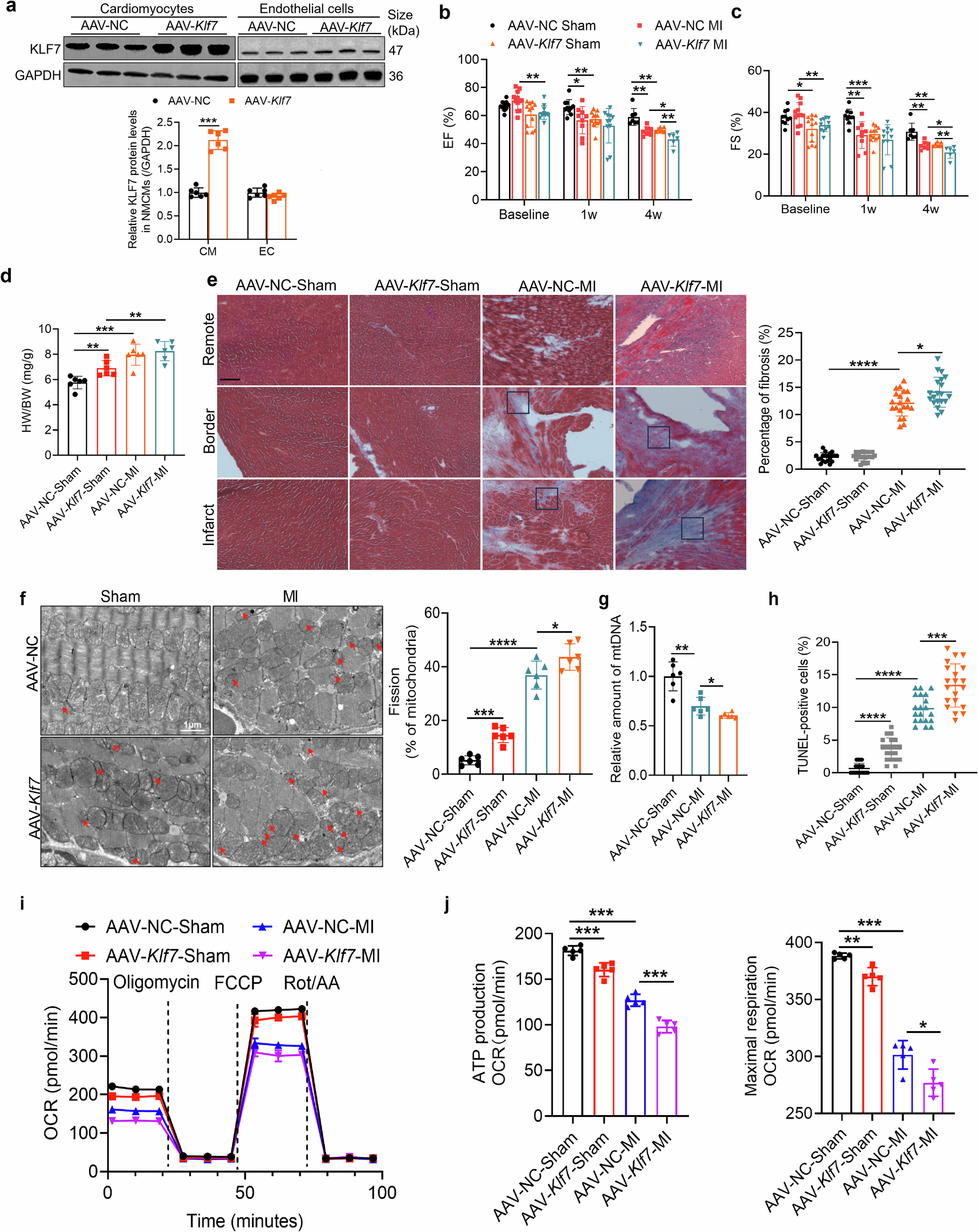 Fig. 4: Cardiomyocyte-specific overexpression of Klf7 aggravates cardiac and mitochondrial dysfunction induced by myocardial infarction.