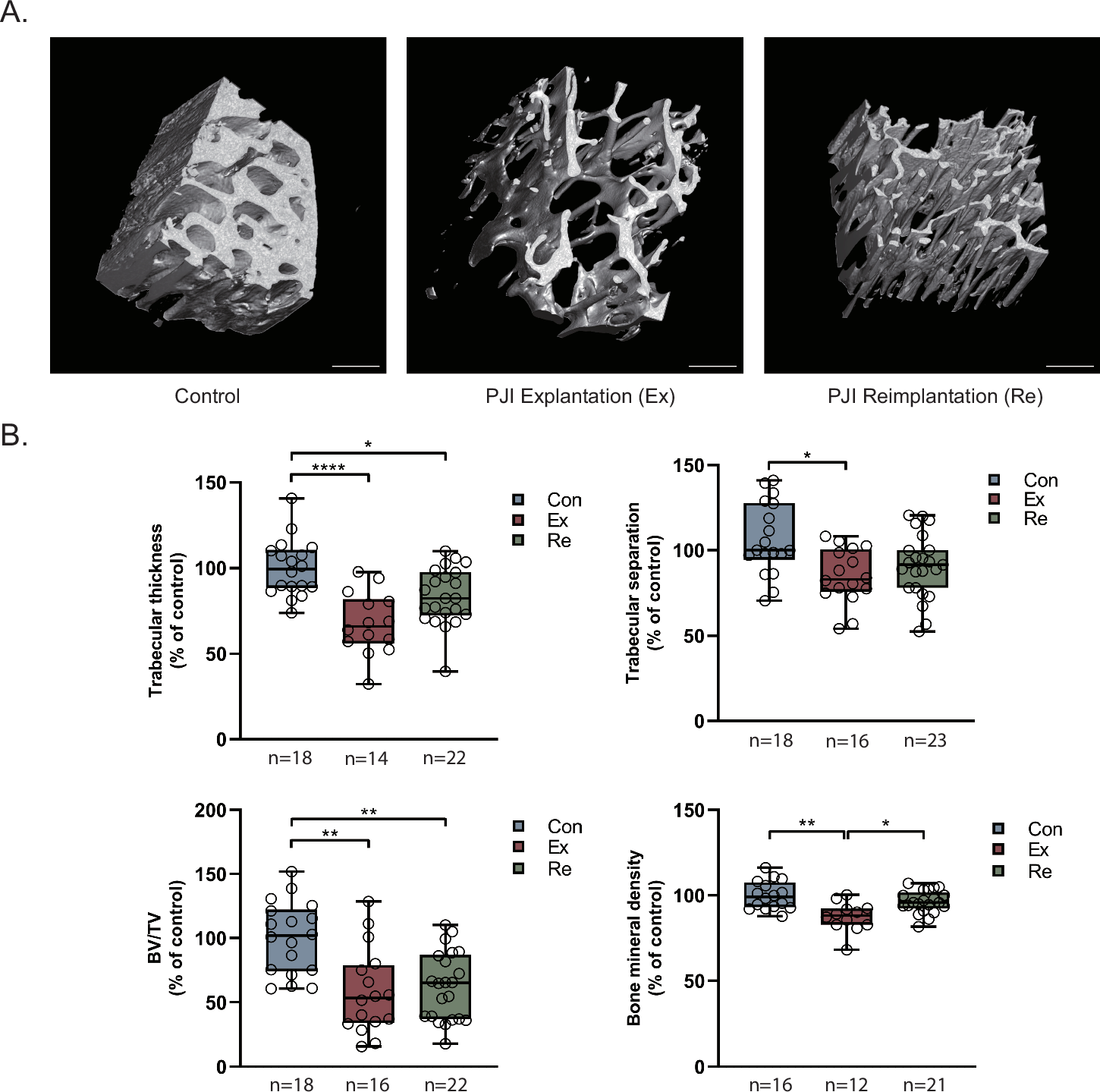 Fig. 1: µCT scans of intra-operatively obtained femoral bone specimens.