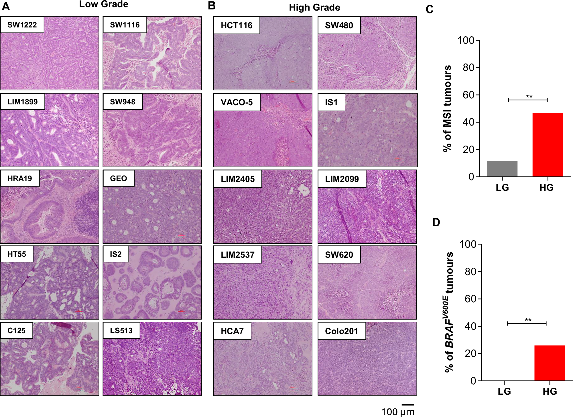Fig. 2: Differentiation grade of CRC cell line xenografts.