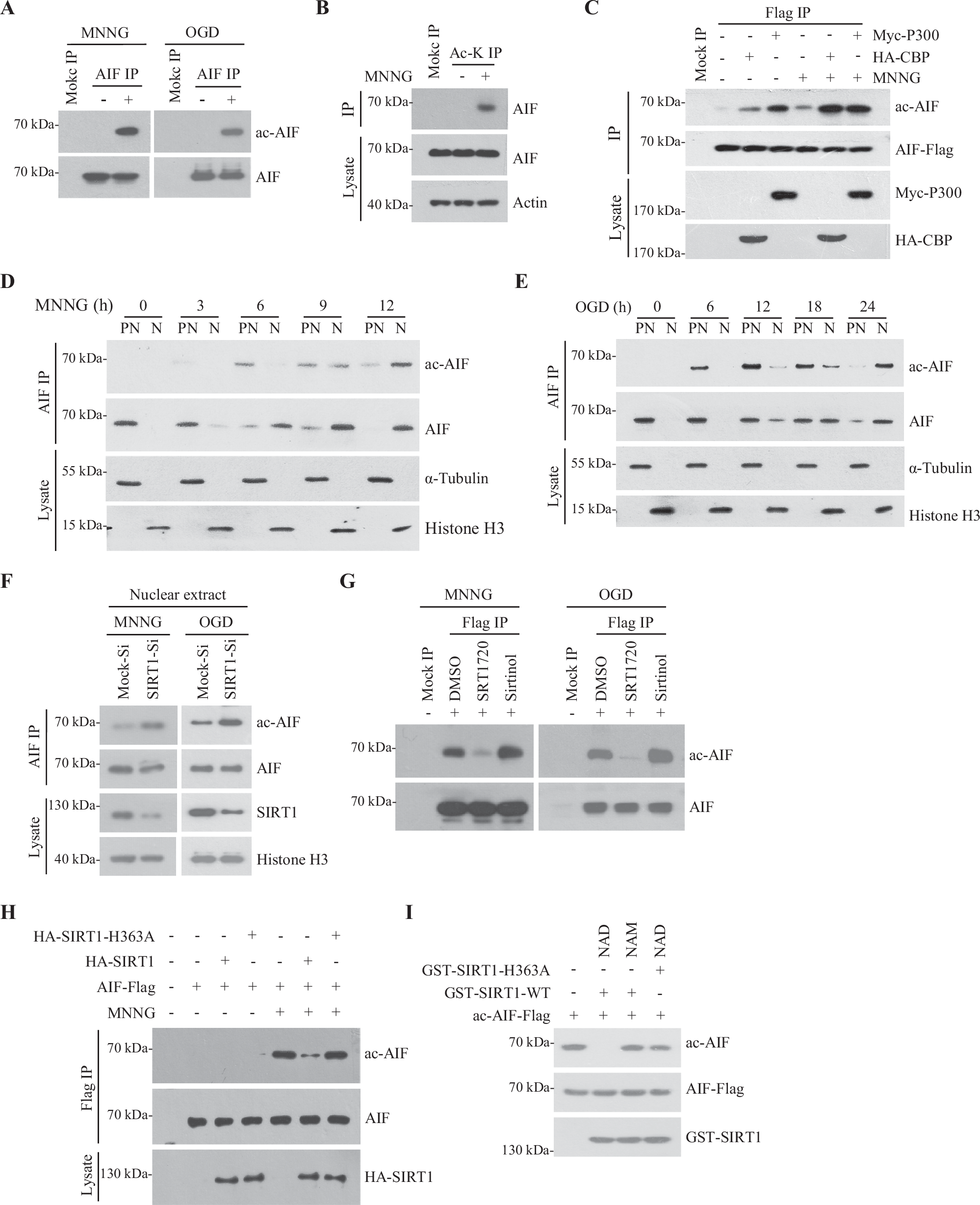 Fig. 3: SIRT1 deacetylates AIF.