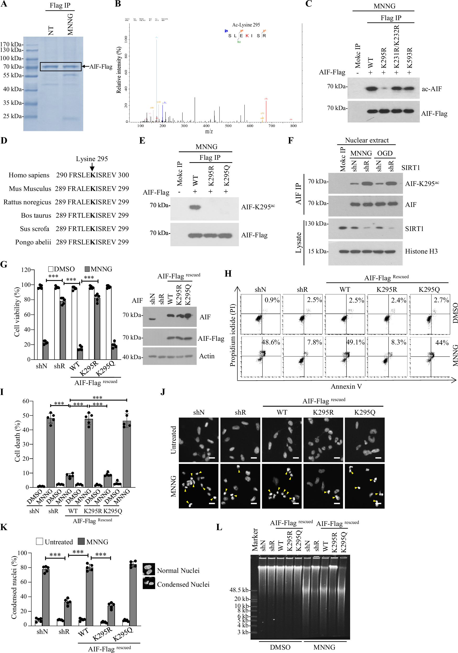 Fig. 4: AIF-K295 acetylation is required for chromatinolysis and programmed necrosis.
