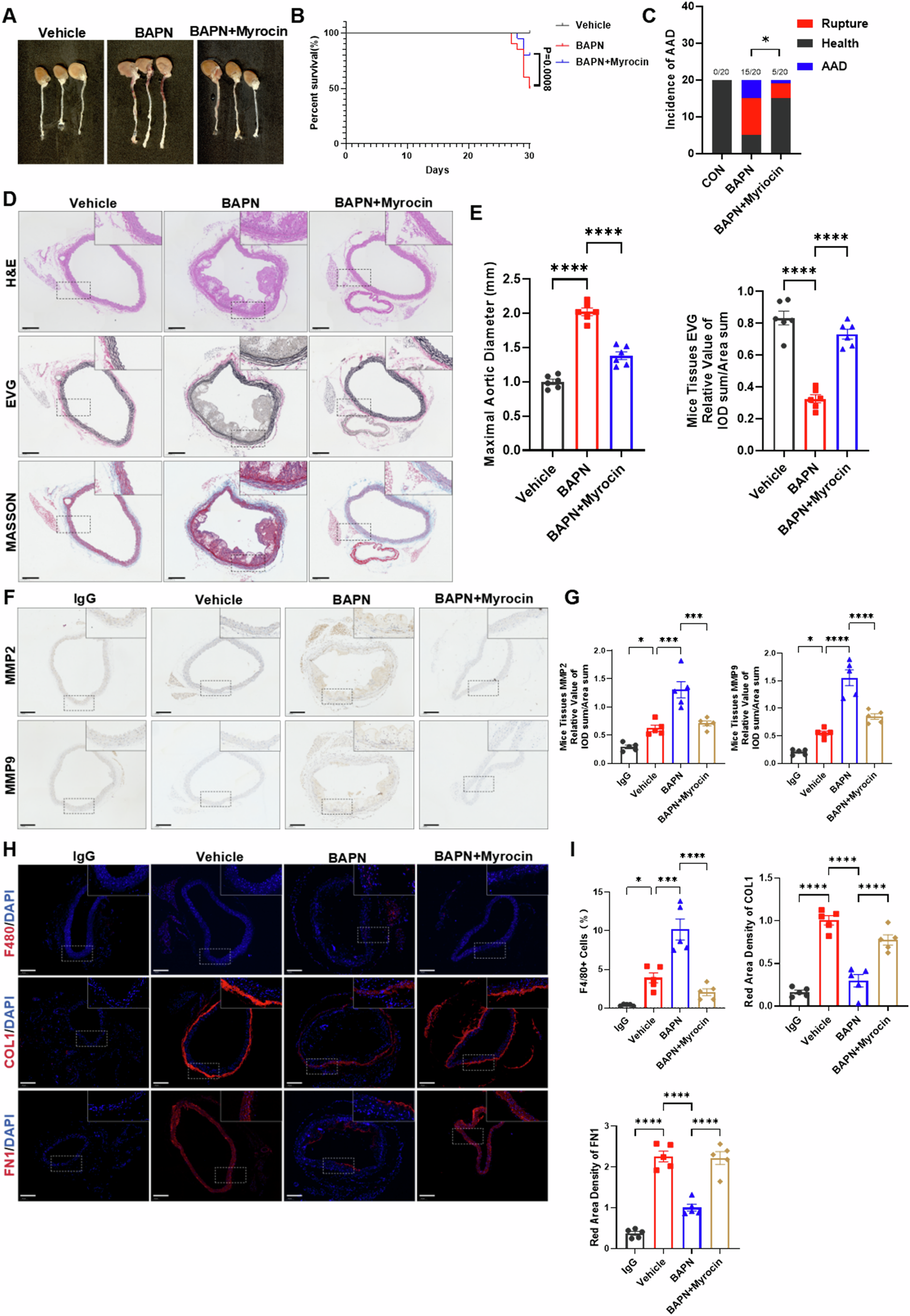 Fig. 5: Inhibiting de novo synthesis of ceramides can reduce the occurrence of AAD.