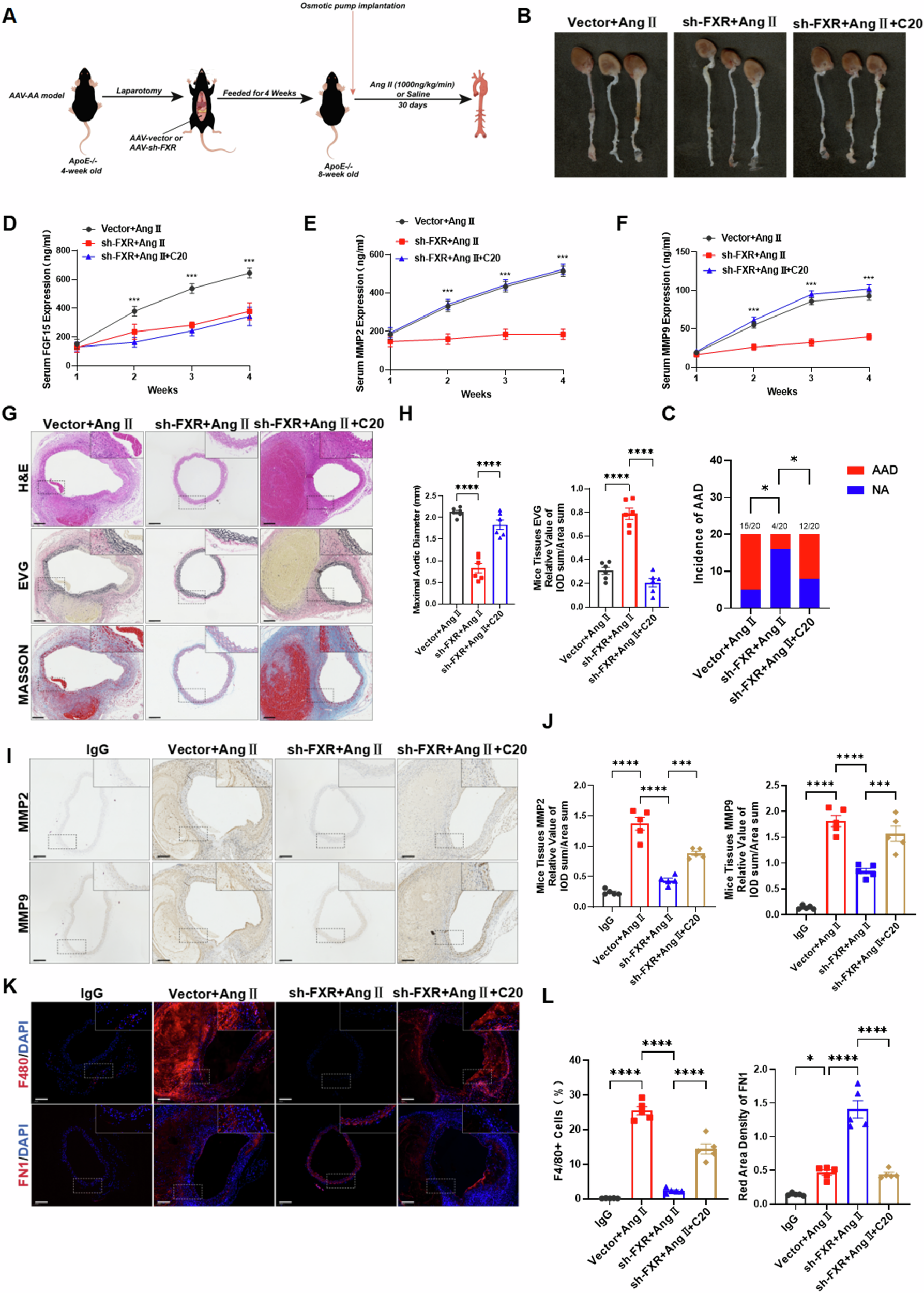Fig. 6: Specific knockout of intestinal FXR can reduce the occurrence and development of AAD, and supplementing with C20 ceramide can eliminate the protective effect of FXR knockout.