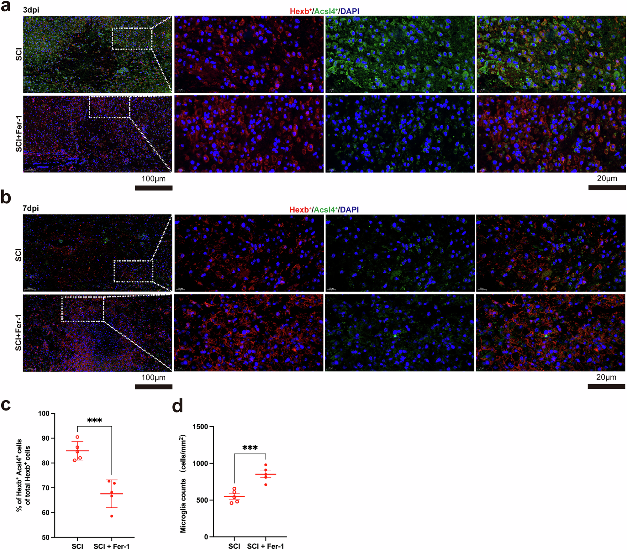 Fig. 8: Ferroptosis inhibitor can alleviate microglial ferroptosis in SCI.