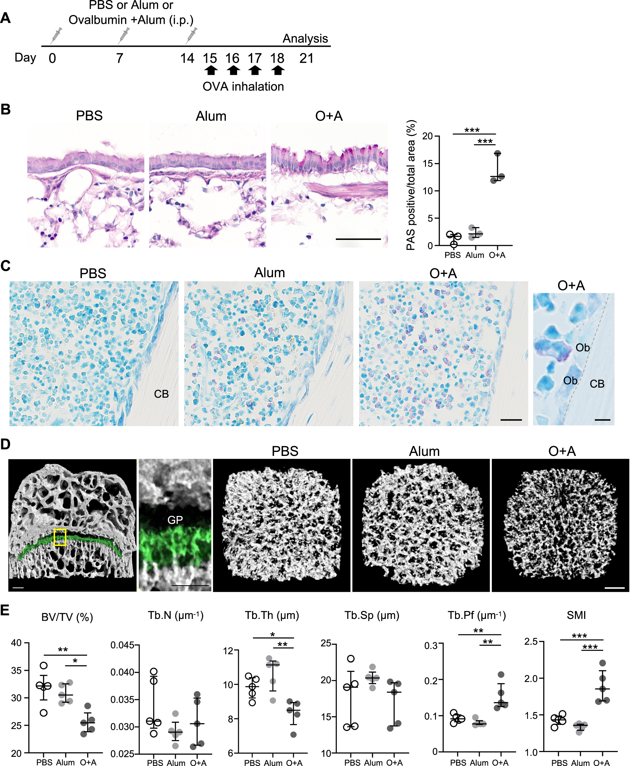 Fig. 1: Bone mass decreased in the femurs of OVA-induced mice.