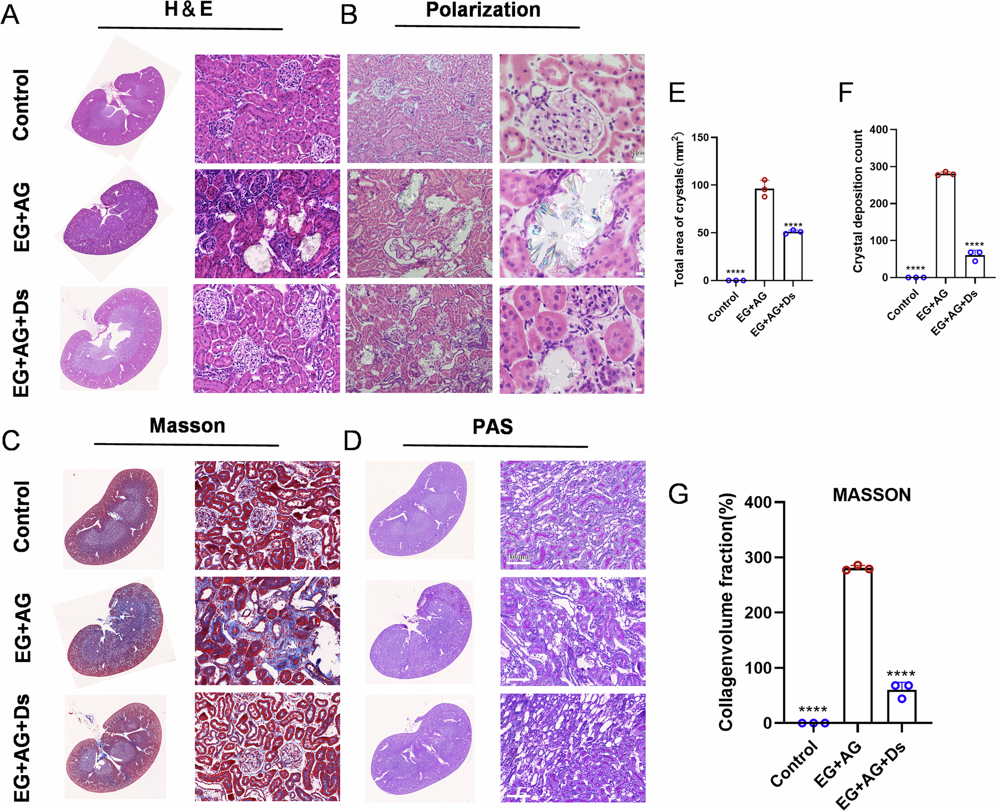 Fig. 3: Ds inhibits intrarenal CaOx deposition and fibrosis in rats.