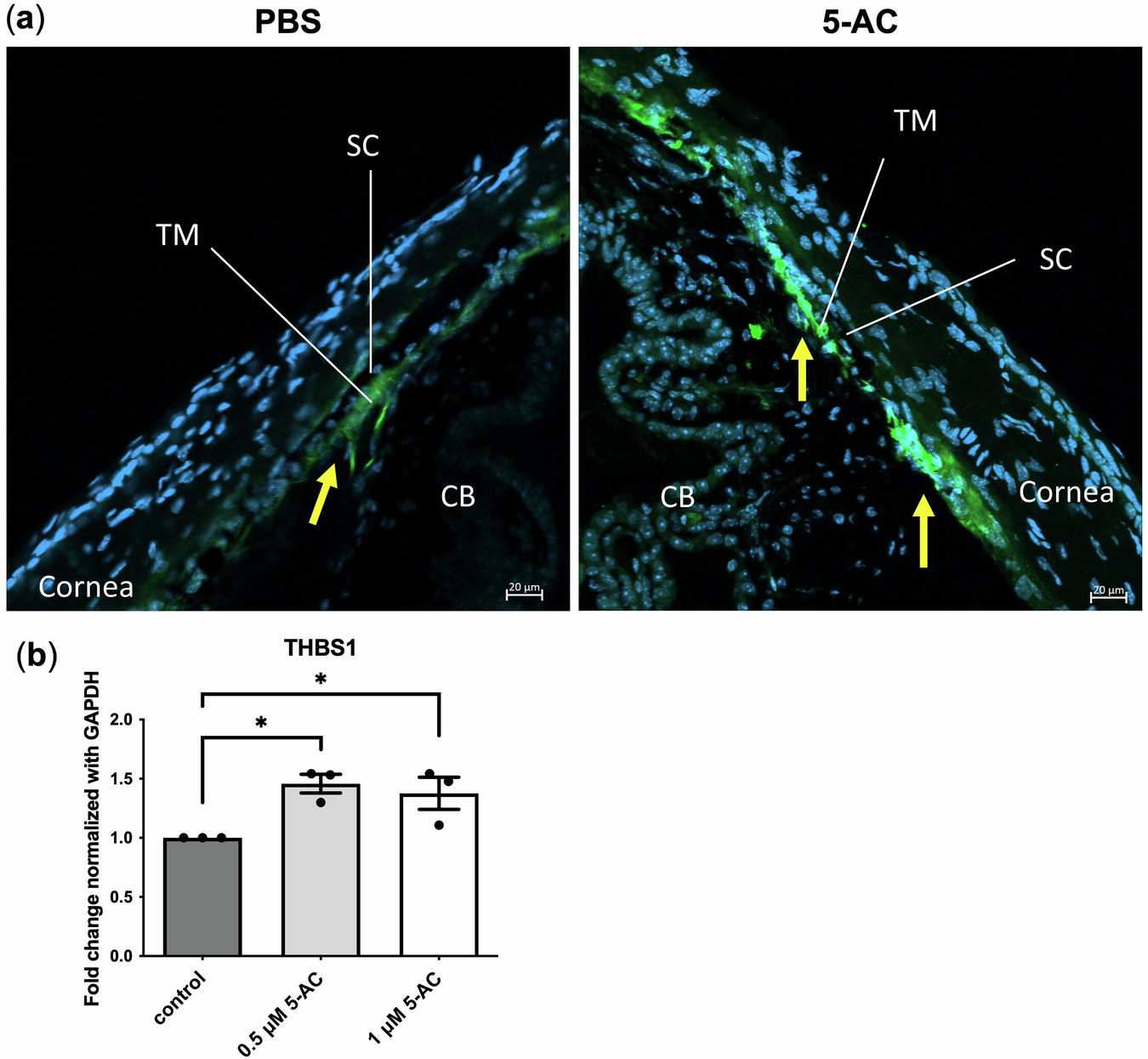 Fig. 3: THBS1 was upregulated after 5-AC treatment in mouse eyes and hTM cells.