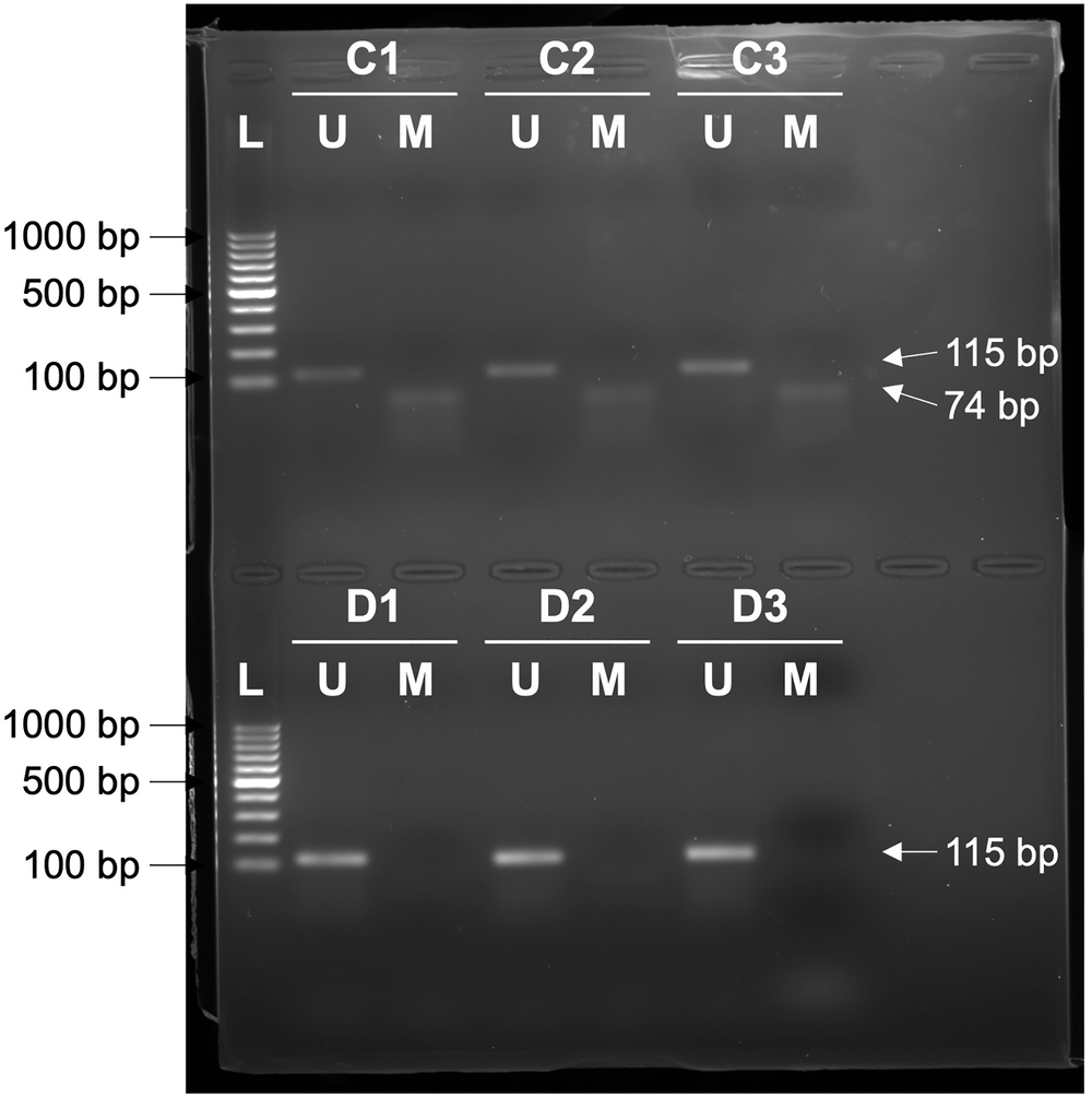 Fig. 4: Analysis of methylation status of THBS1 promoter in DEX- and vehicle-control hTM cells detected by MSP.