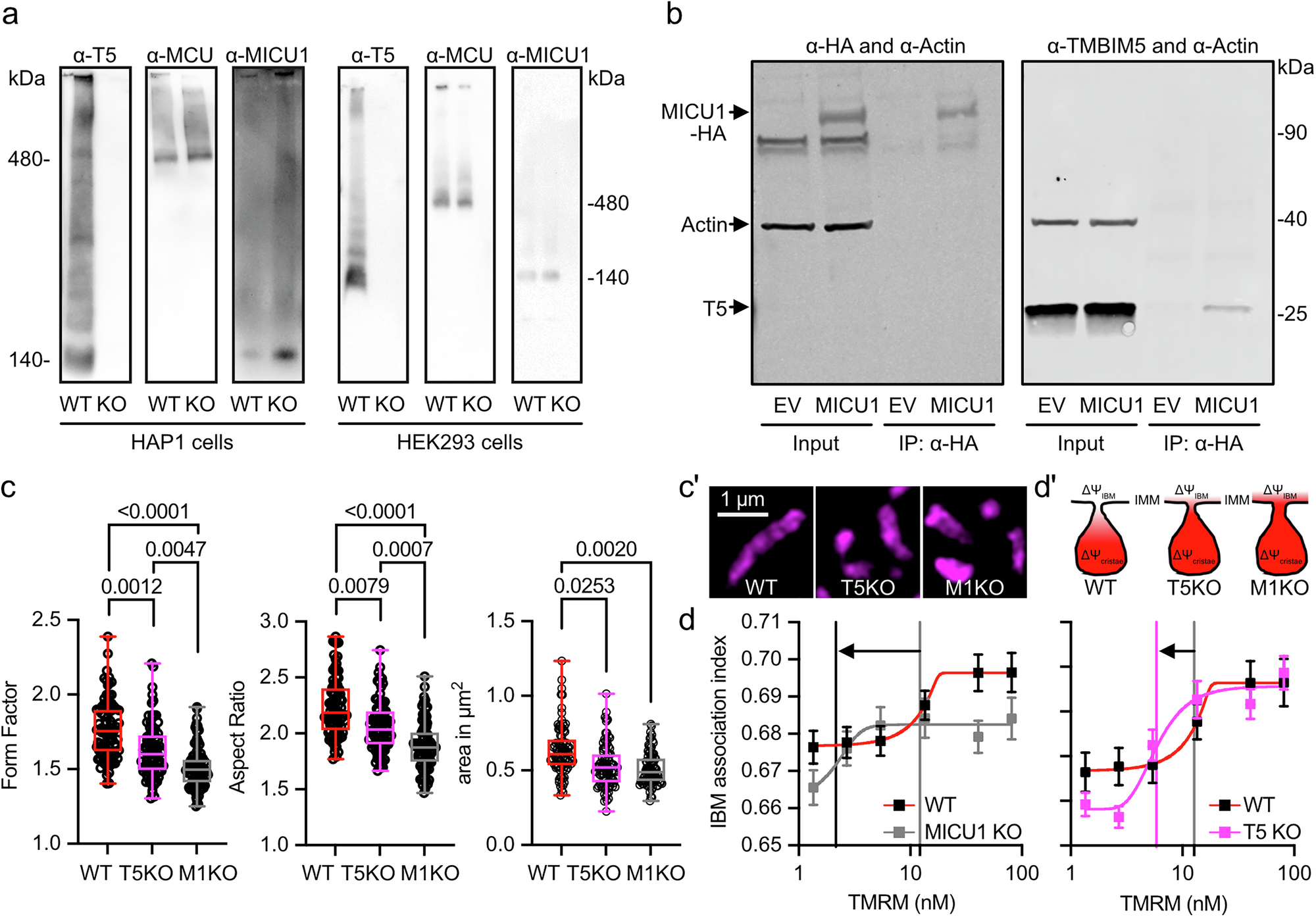 Fig. 4: TMBIM5 and MICU1 are found in the same macromolecular complex and their deficiency results in similar changes in mitochondrial shape and inner boundary membrane.