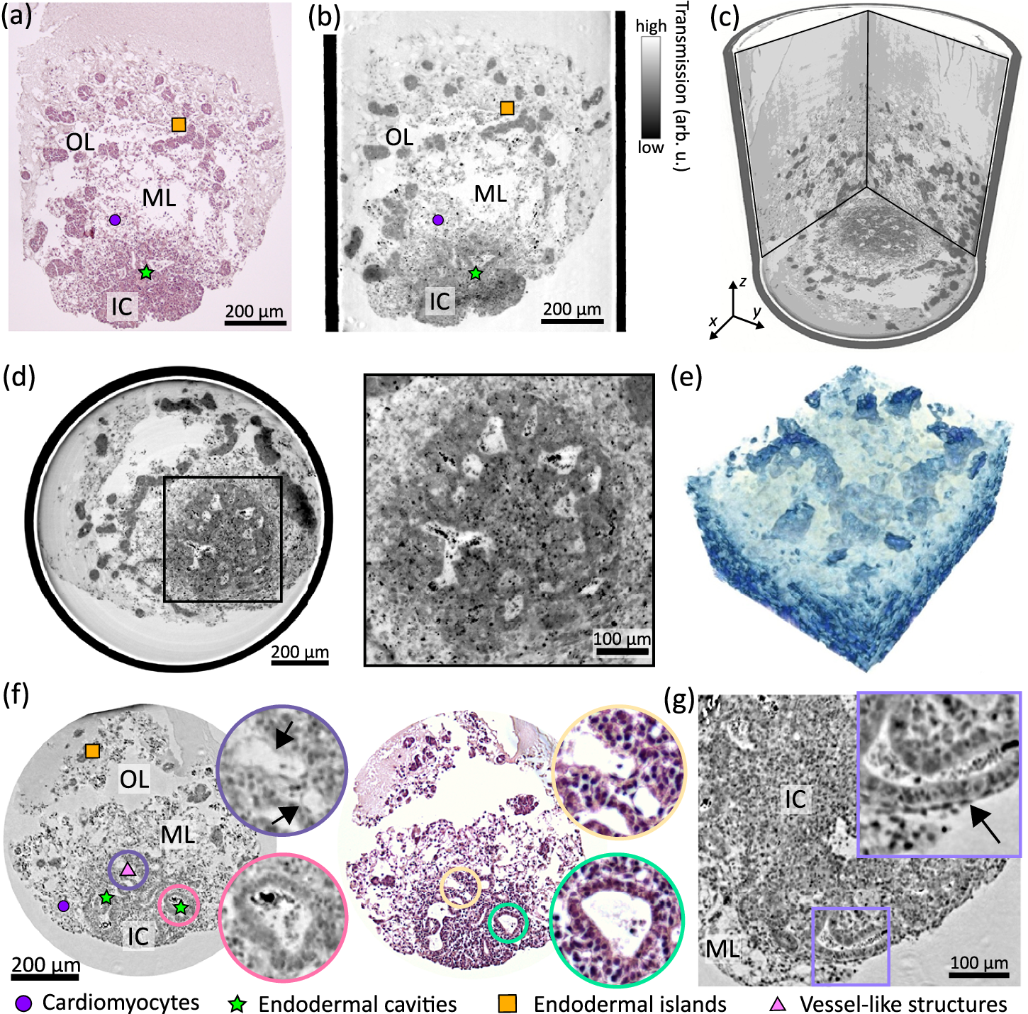 Fig. 3: 3D virtual histology of HFOs by parallel-beam synchrotron radiation and correlative imaging.