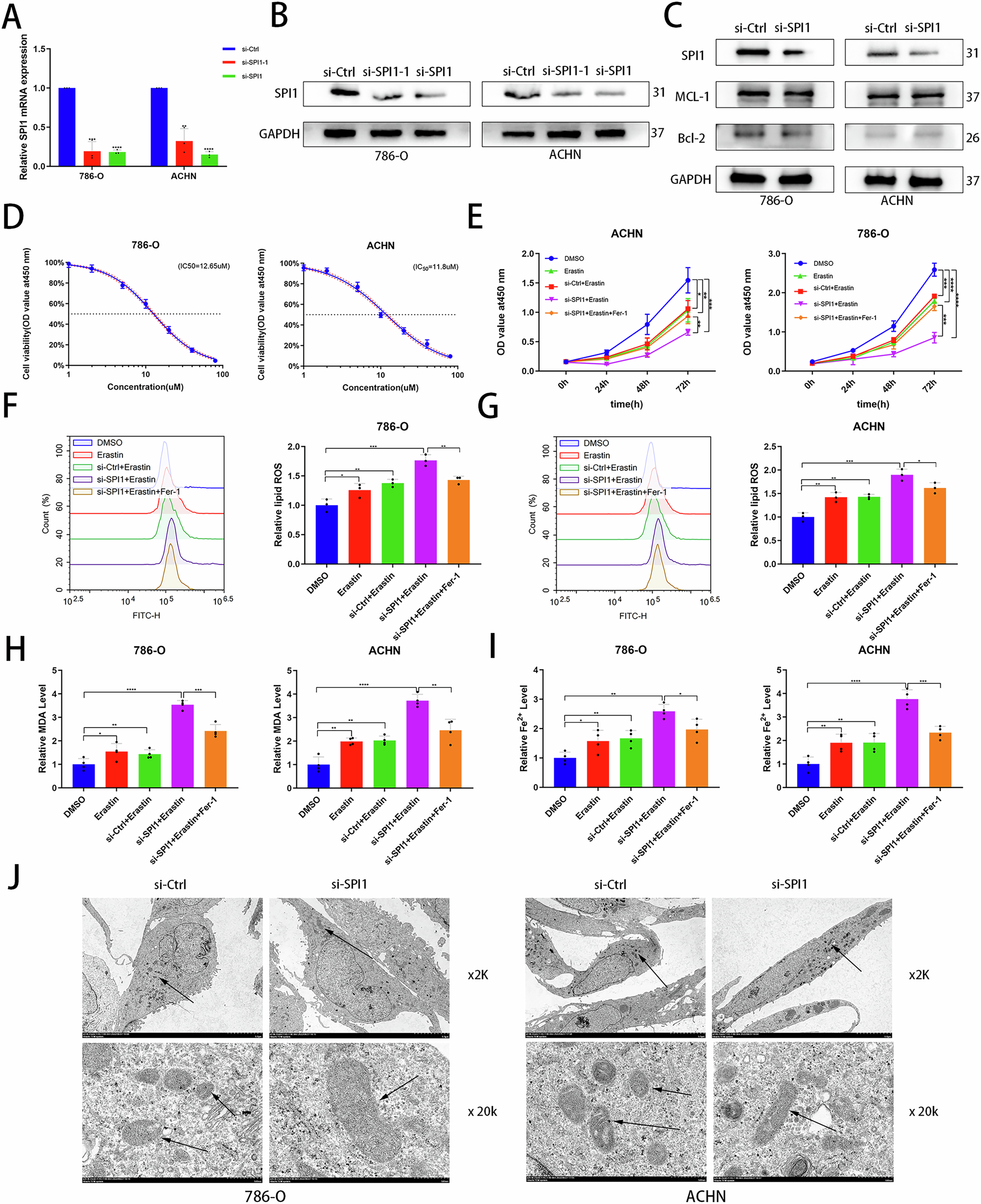 Fig. 2: Knockdown of SPI1 promotes ferroptosis in ccRCC.