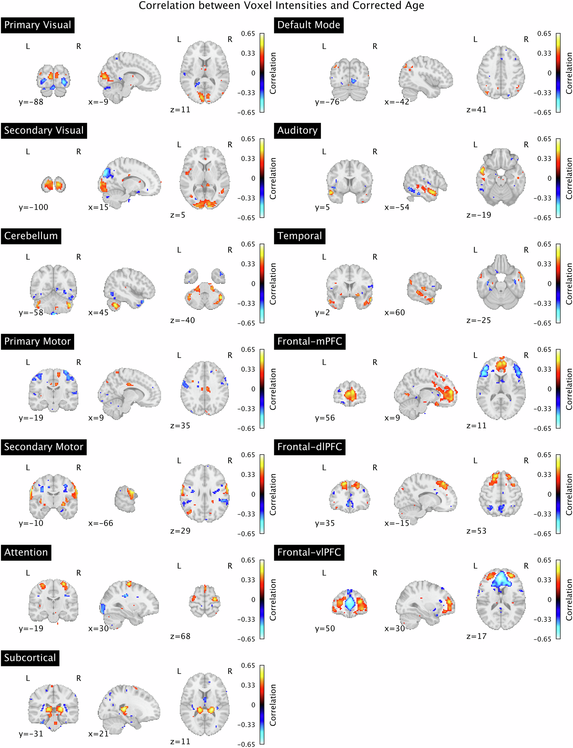 Fig. 3: Correlation between voxel intensities and corrected age.