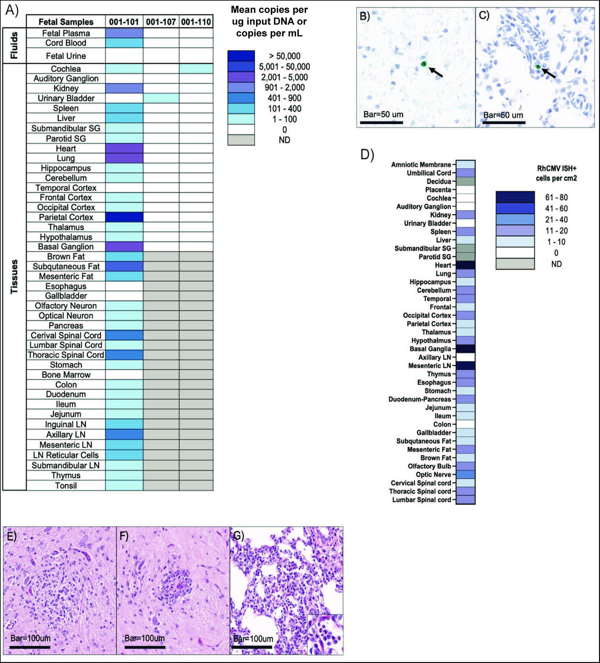 Fig. 3: Fetal cCMV infection and pathology.