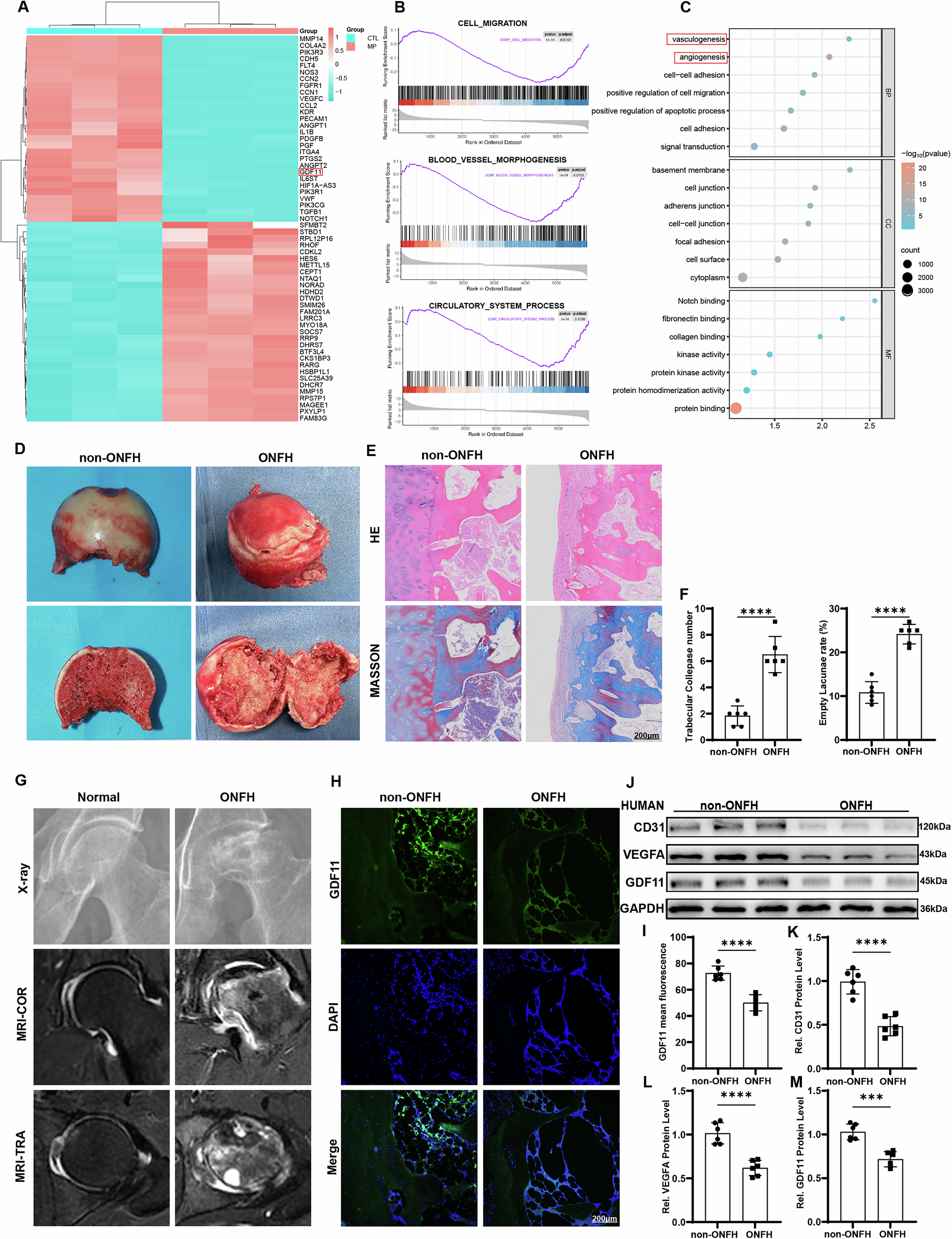 Fig. 1: GDF11 plays a key role in GC-induced ONFH.