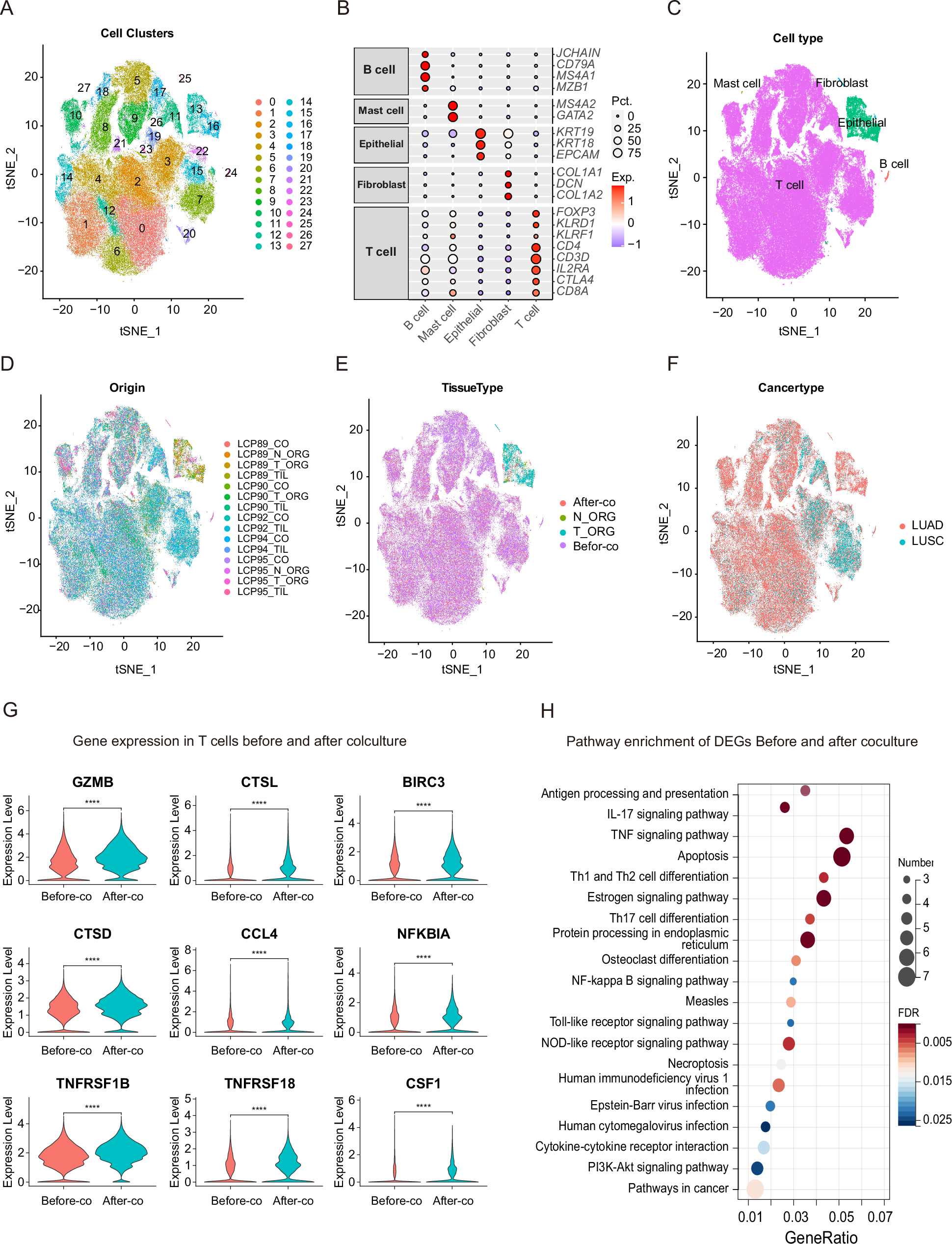 Fig. 4: Unraveling the molecular mechanism involved in TIL-lung cancer organoid interaction through single-cell RNA sequencing analysis.