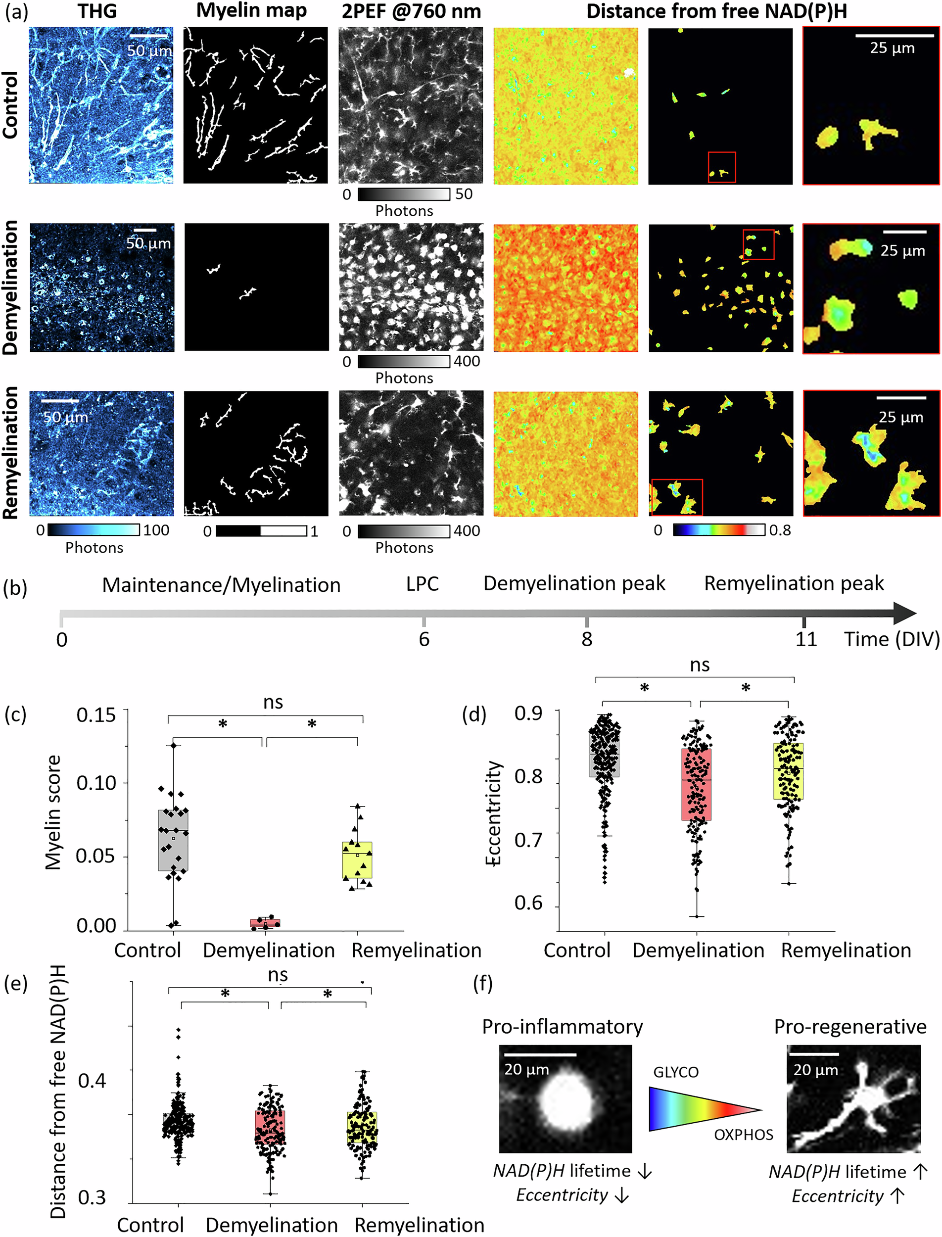 Fig. 4: Metabolic shifts in microglia during demyelination and remyelination.