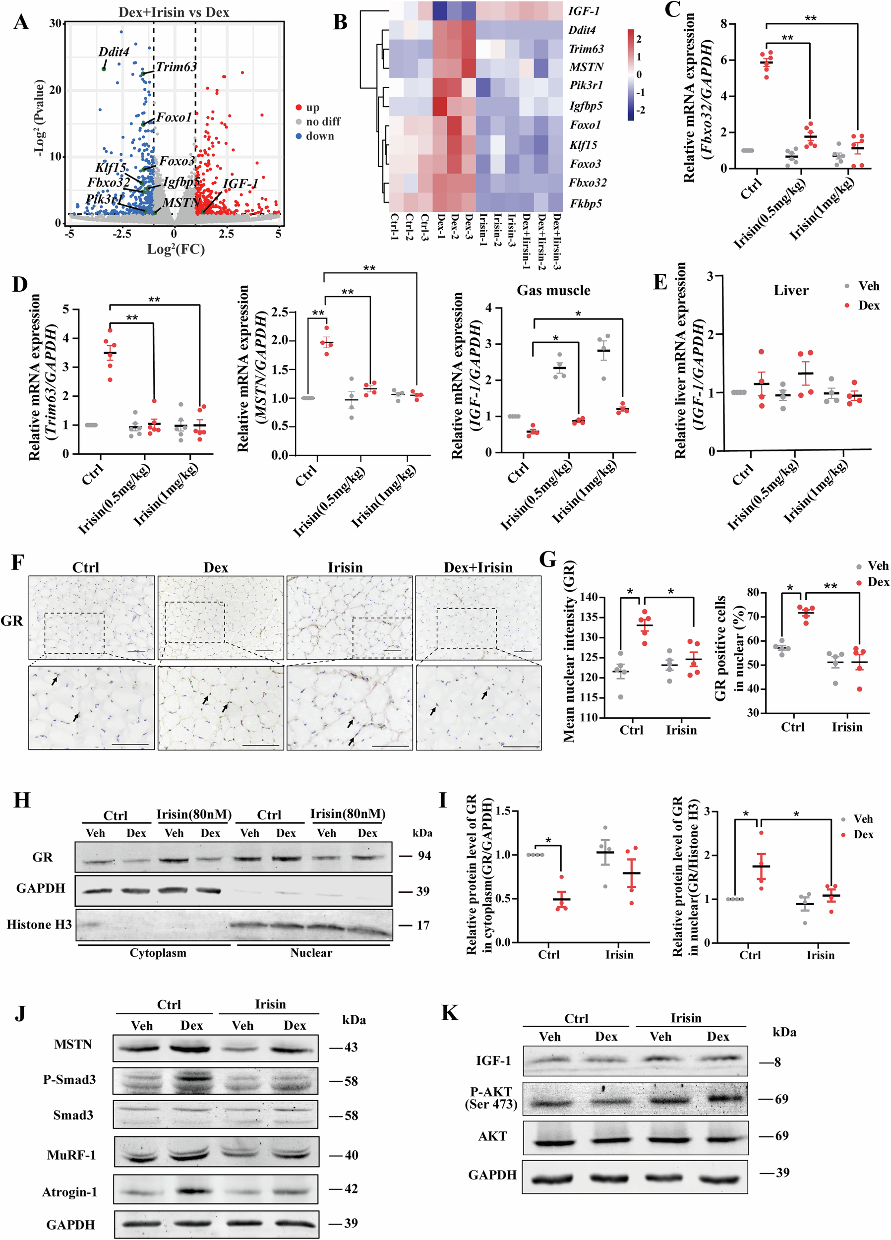 Fig. 4: Irisin inhibits the nuclear translocation of the GC receptor and GC genomic effects.
