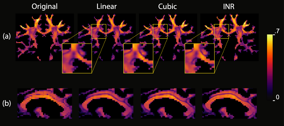 Fig. 7: Comparisons between different upsampling methods.