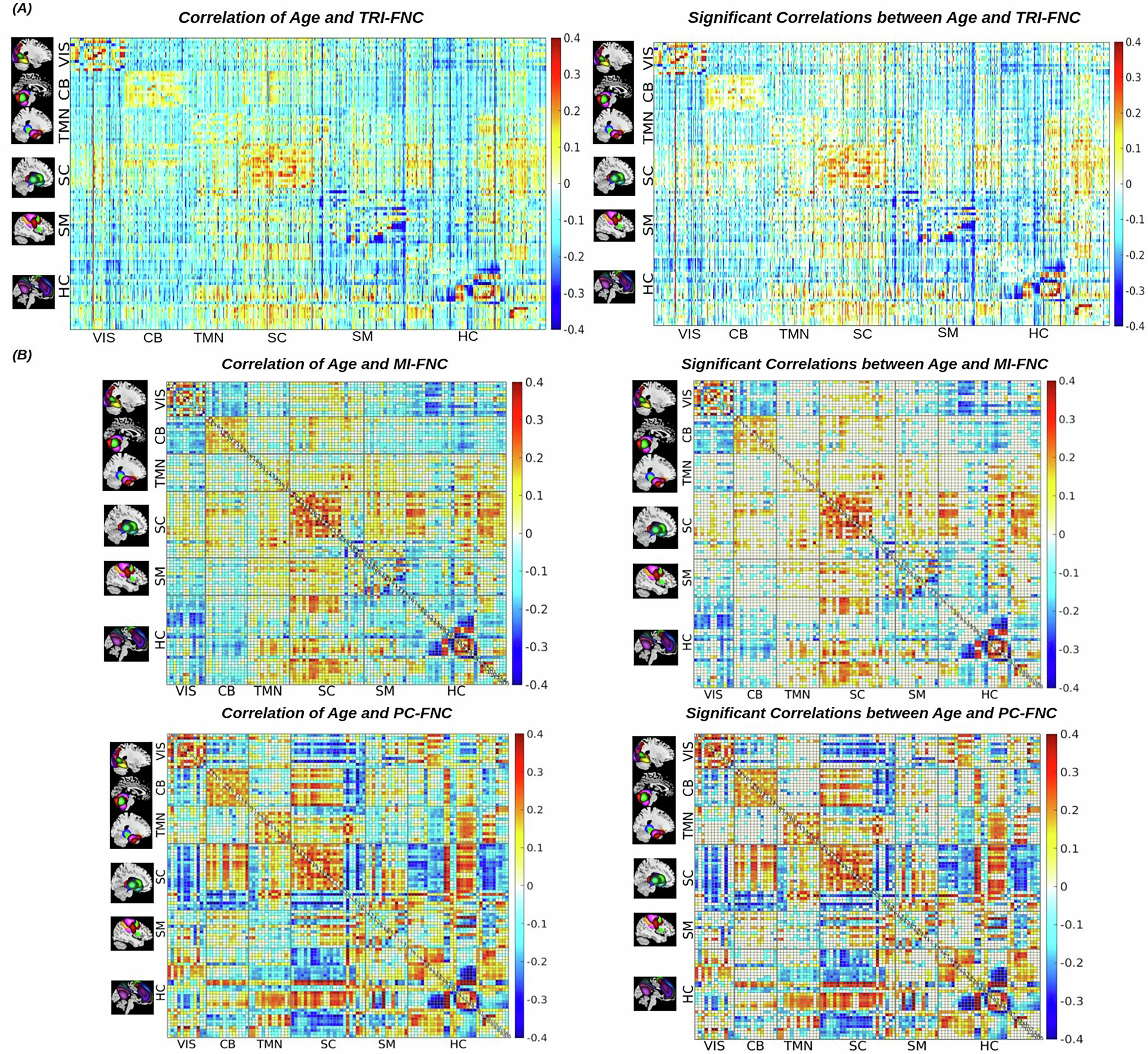 Fig. 2: Triple and pairwise brain network interactions in the infant brain and their associations with age.