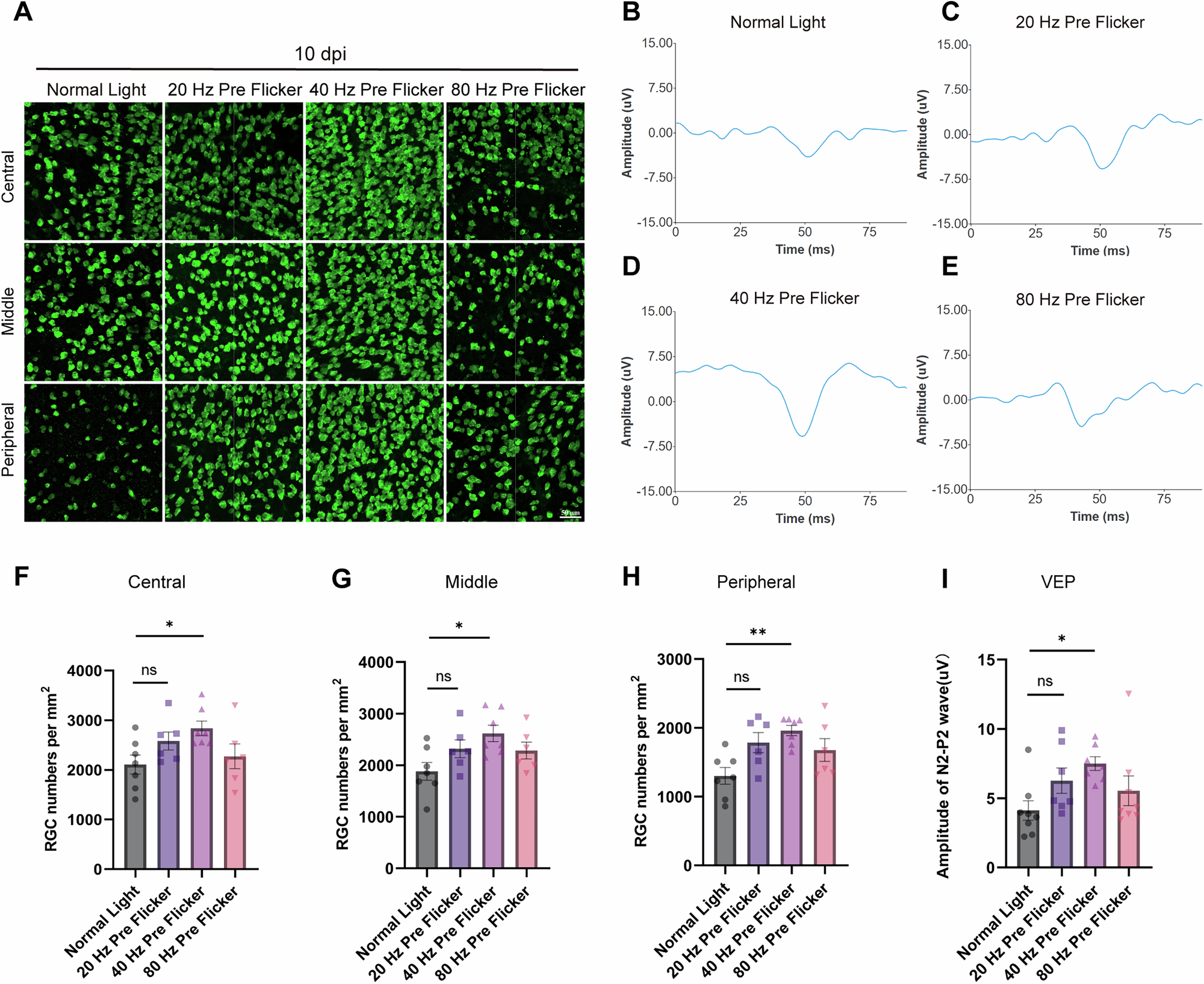Fig. 5: The neuroprotective effect of 40 Hz flicker preconditioning on NAION was flicker frequency-specific.