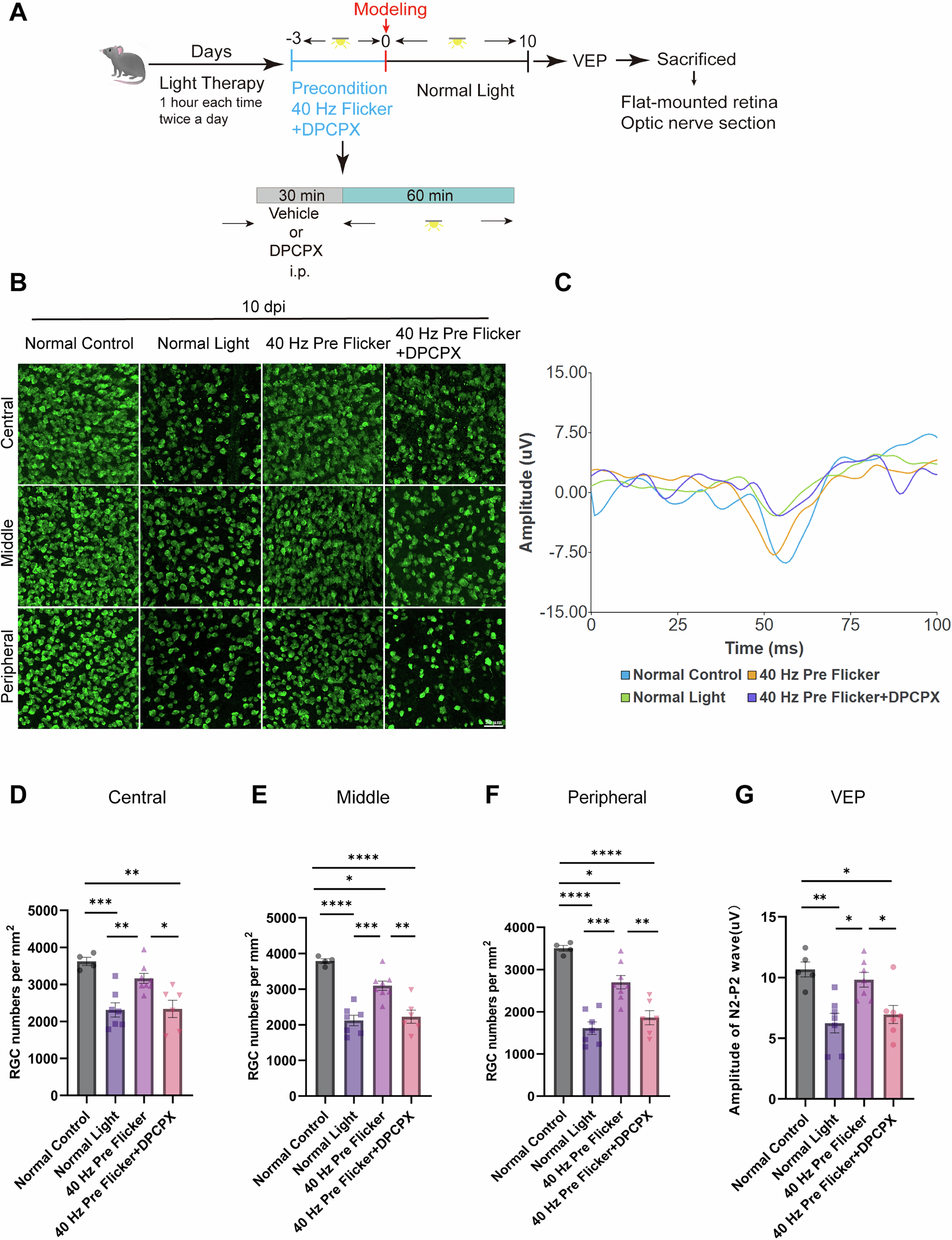 Fig. 7: The neuroprotective effect of 40 Hz flicker preconditioning was reversed by the A1R antagonist DPCPX, both in cellular protection and visual function.