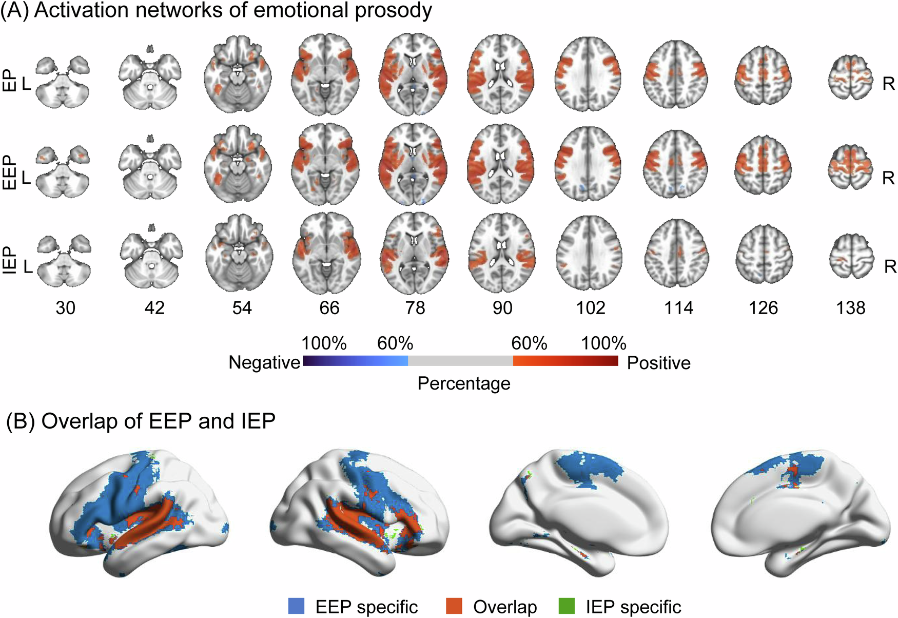Fig. 1: The activation networks of emotional prosody based on overall cohort.