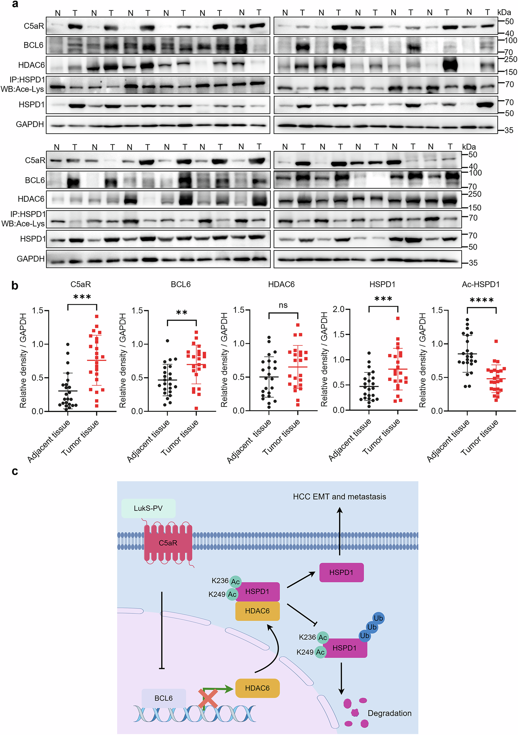 Fig. 8: LukS-PV targets C5aR to inhibit EMT in HCC via the BCL6/HDAC6/HSPD1 axis.