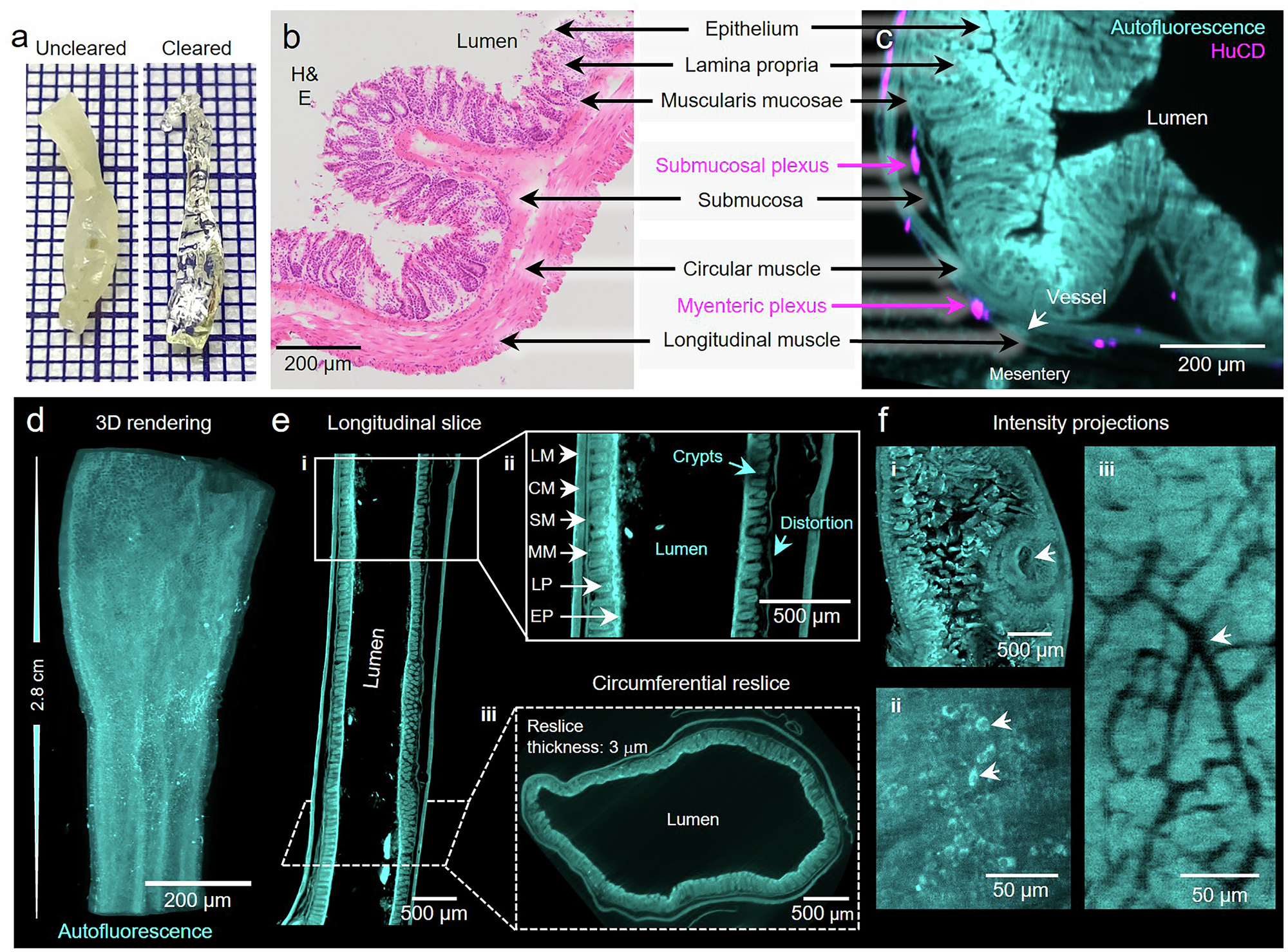 Fig. 2: Microscopic observation of gut architecture in mouse tissue.