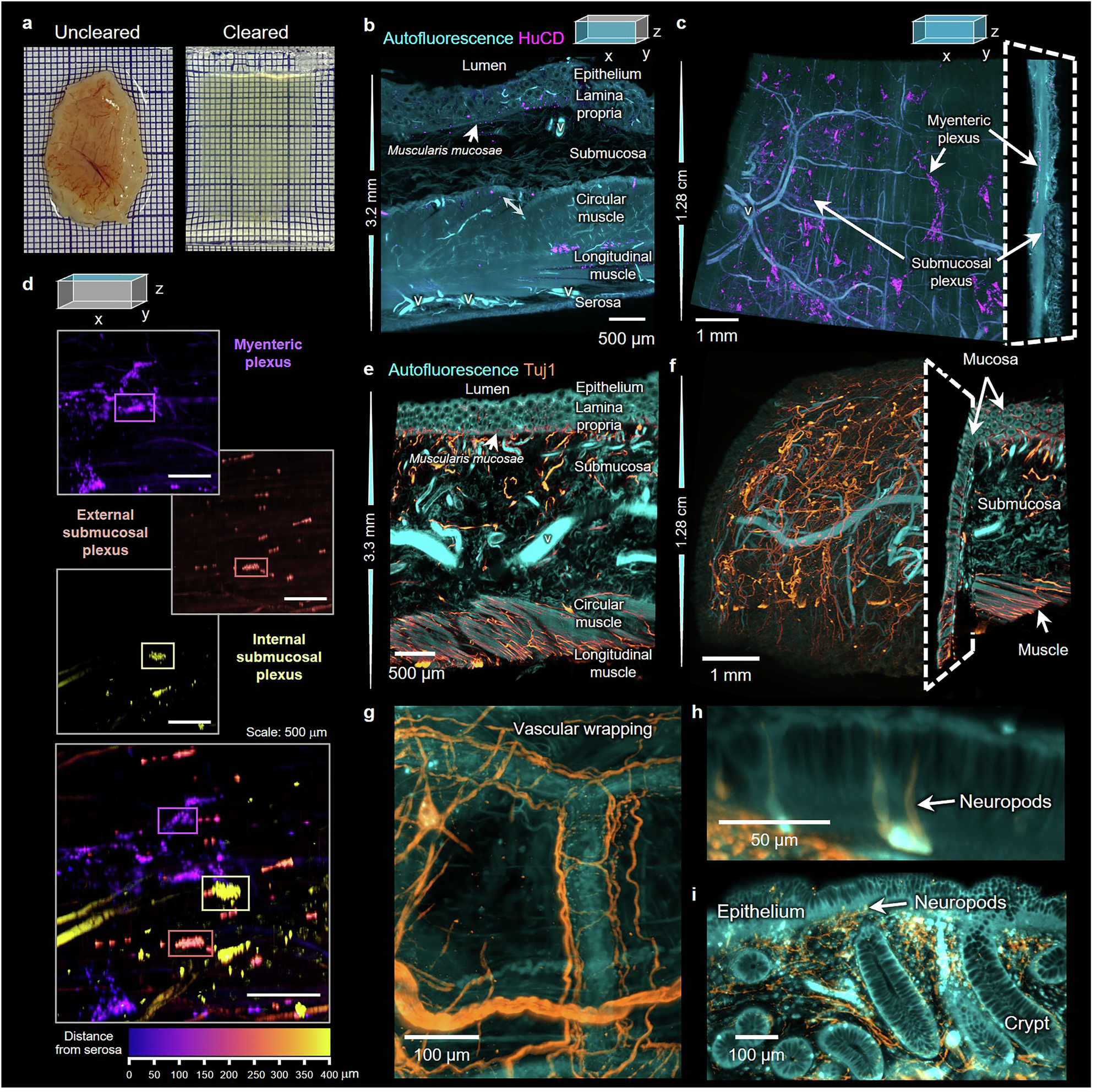Fig. 5: Enteric nervous system at the network scale in healthy human colon resections.