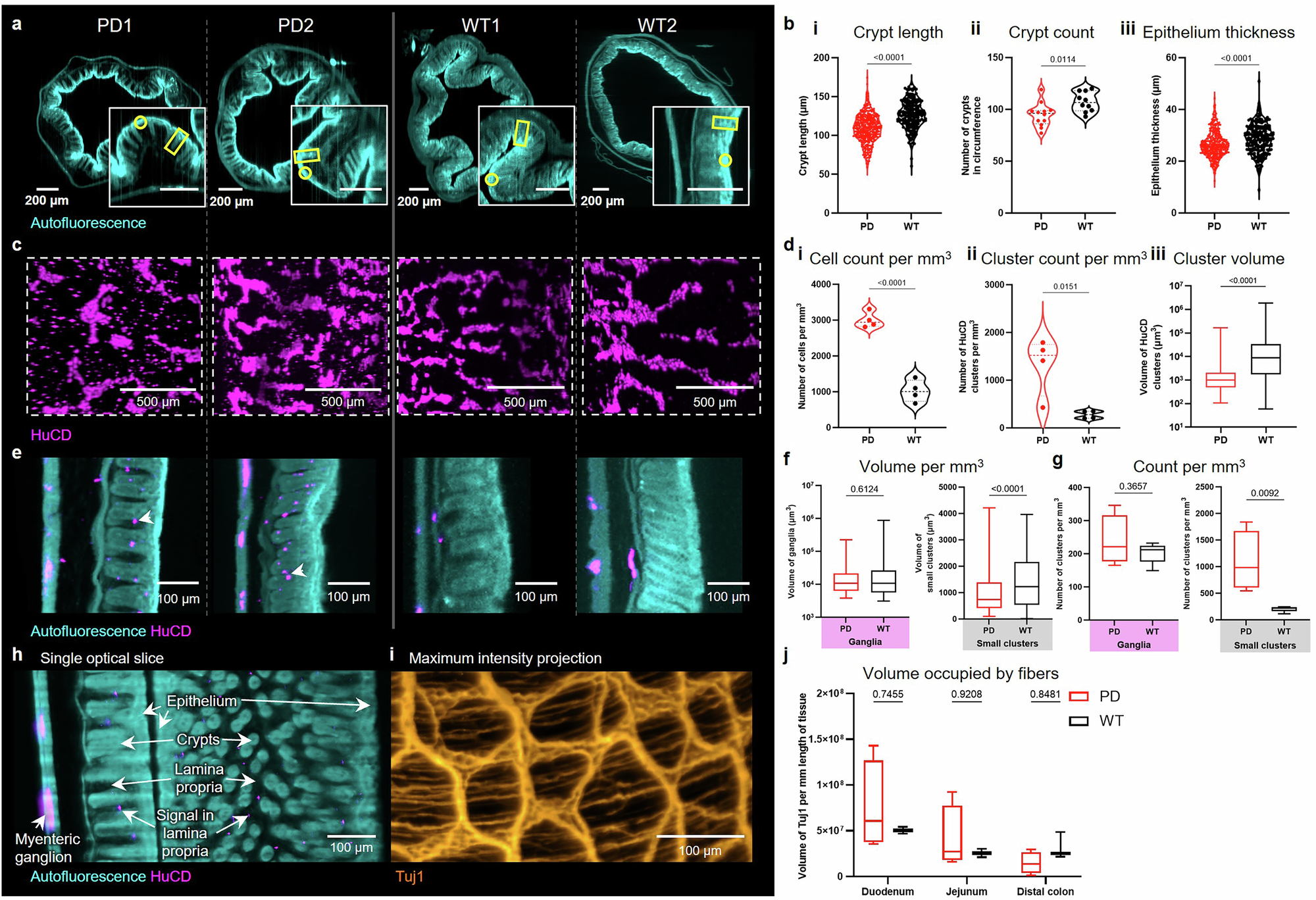Fig. 6: Exploring ENS morphology remodeling in a genetic model of Parkinson’s disease.
