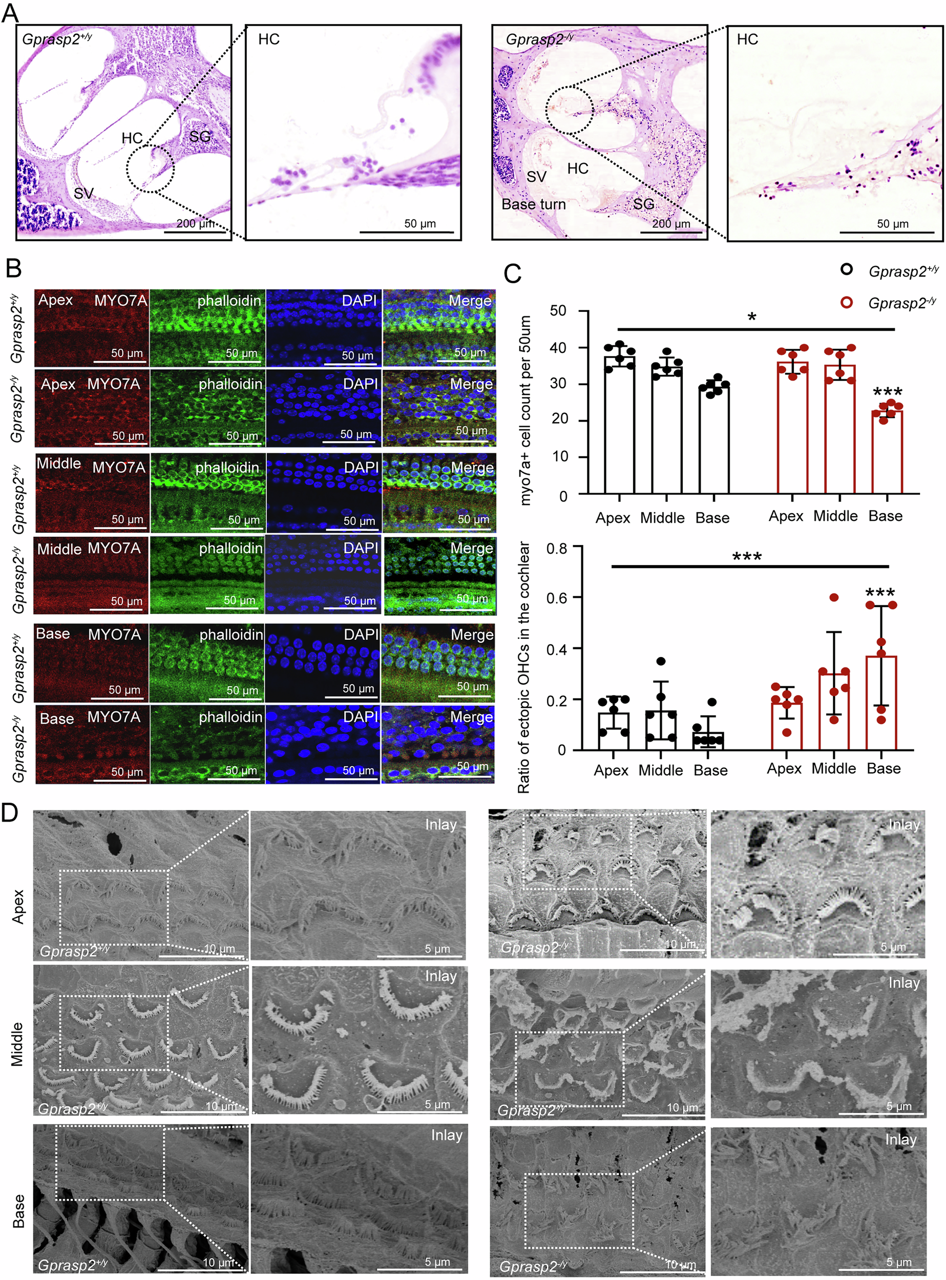 Fig. 2: The structure examination of the cochlea between Gprasp2-deficient mice and WT mice.