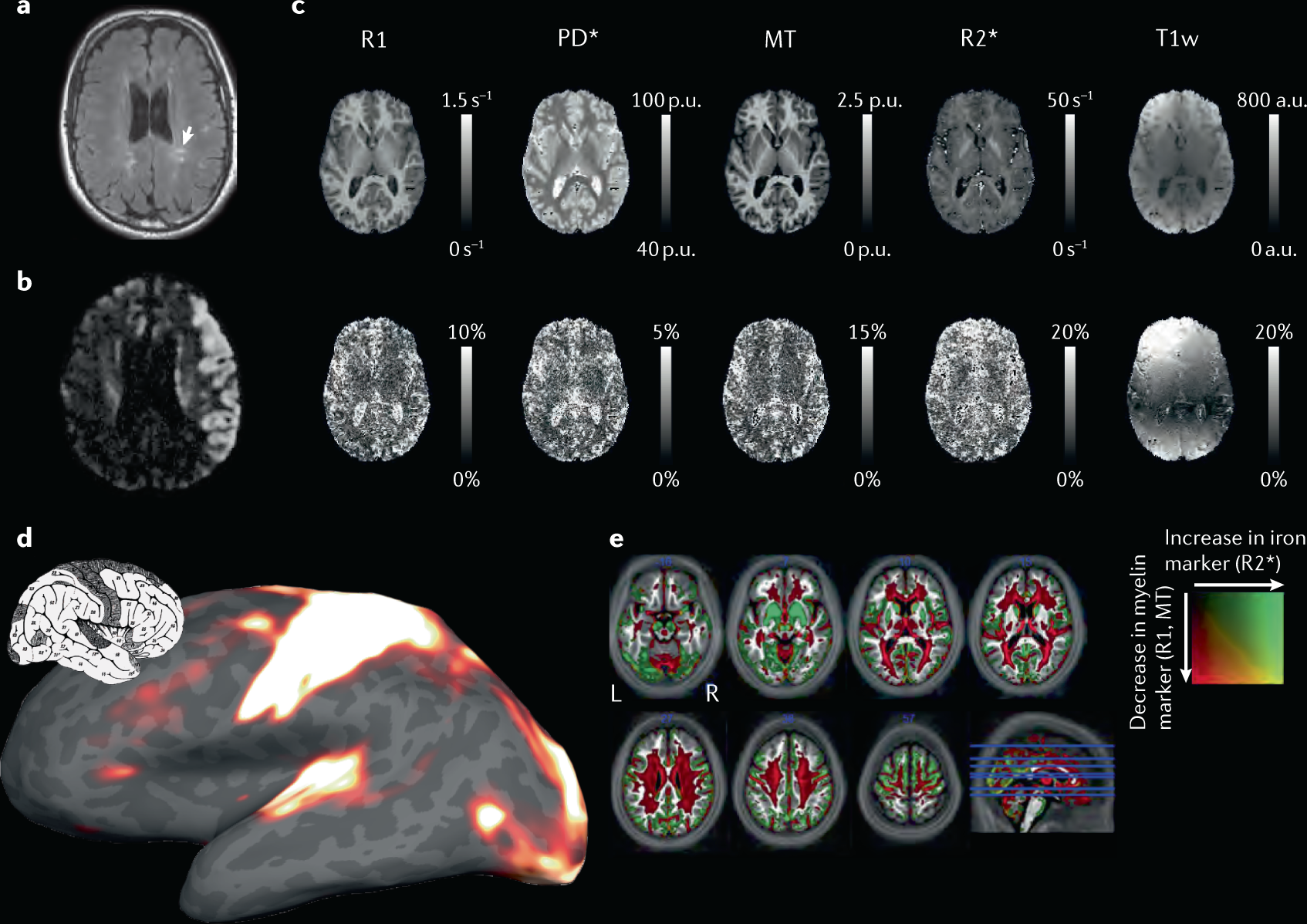 Quantitative magnetic resonance imaging of brain anatomy and in vivo  histology | Nature Reviews Physics