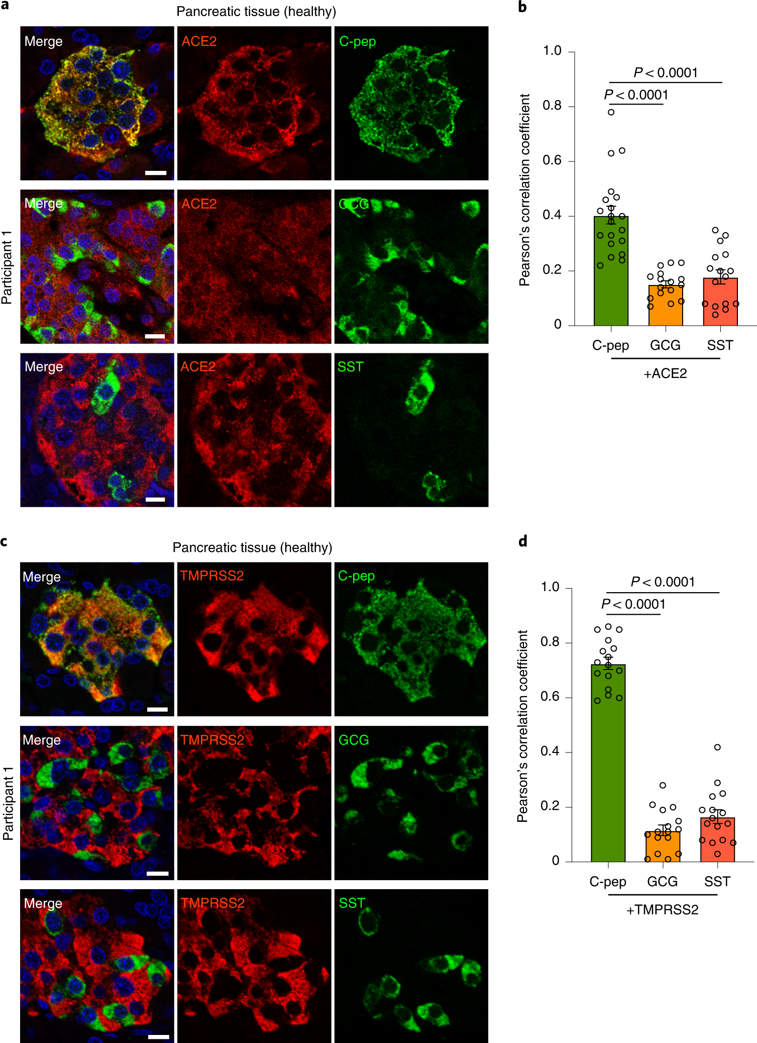 SARS-CoV-2 infects and replicates in cells of the human endocrine and  exocrine pancreas | Nature Metabolism