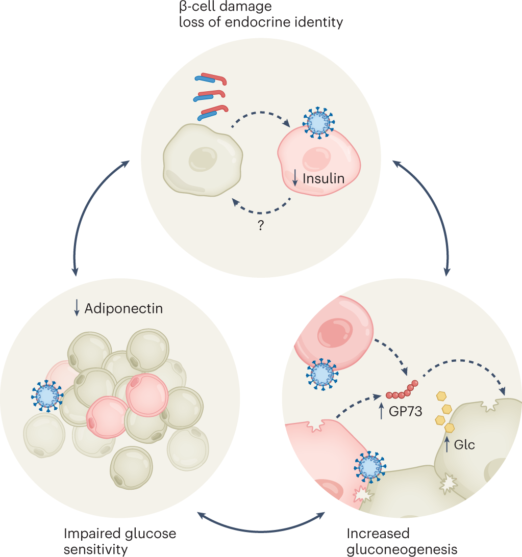 COVID 20 and diabetes — where are we now   Nature Metabolism