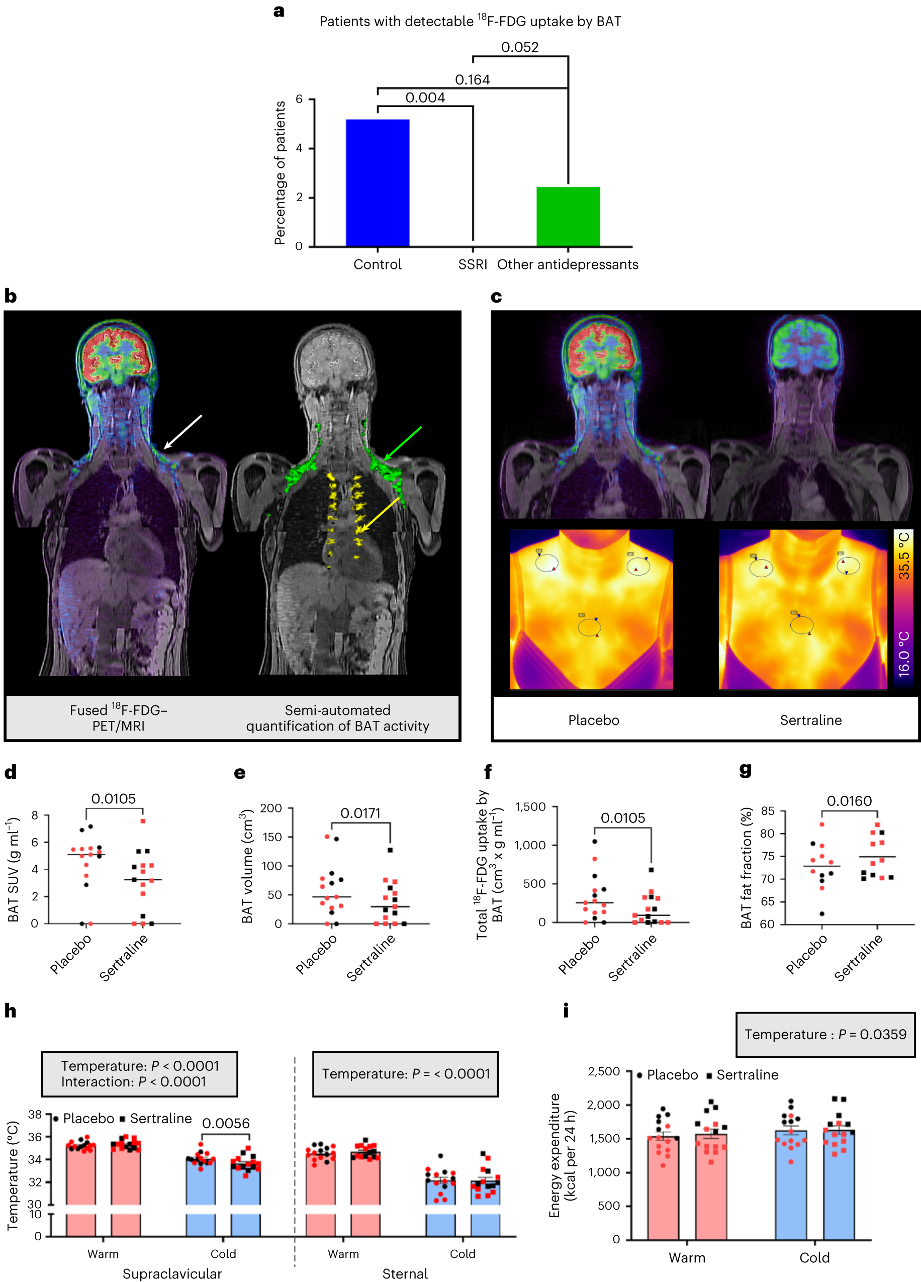 Fig. 3: SERT inhibition suppresses BAT thermogenesis in vivo in humans.