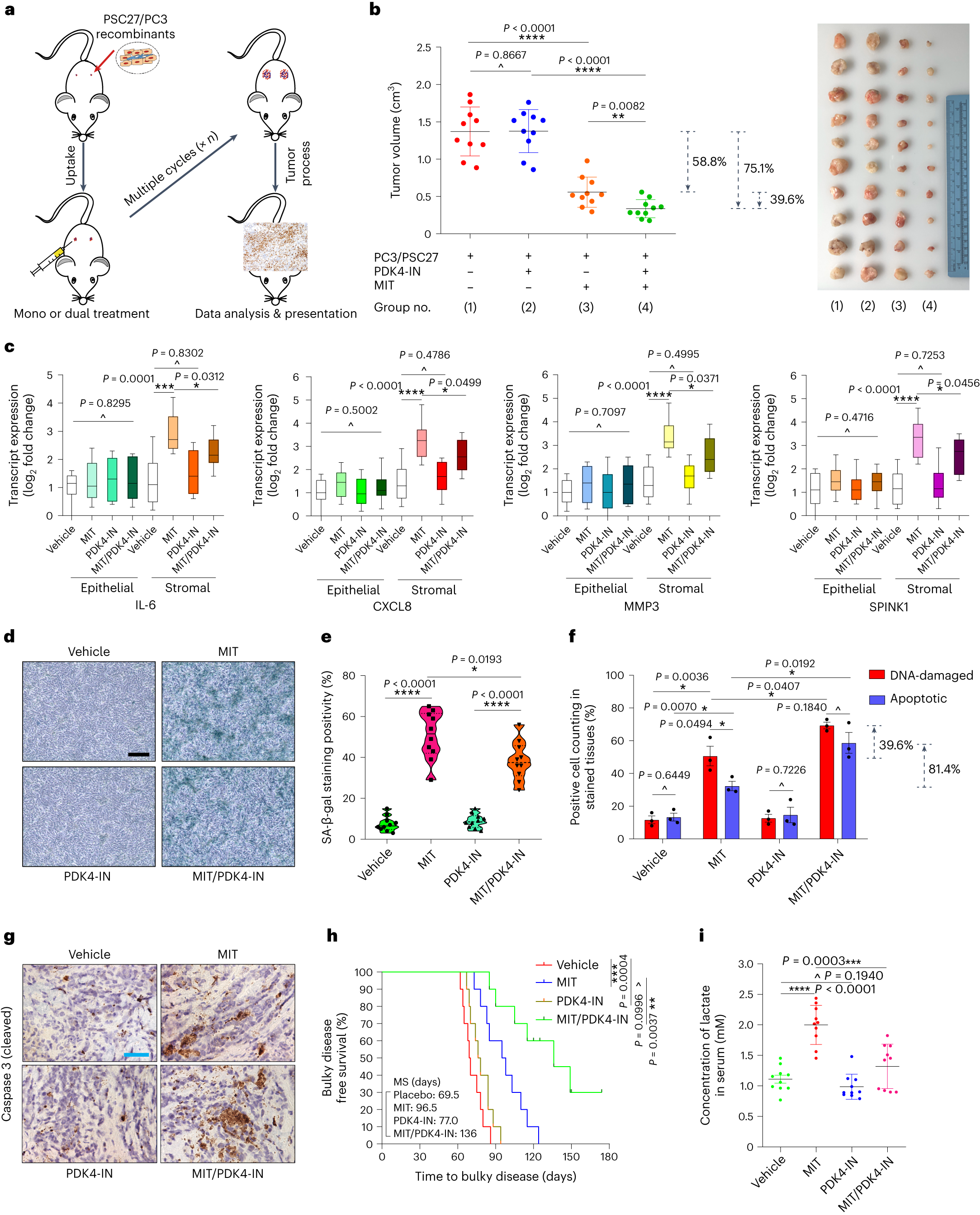 Fig. 5: Therapeutically targeting PDK4 promotes anticancer outcome.