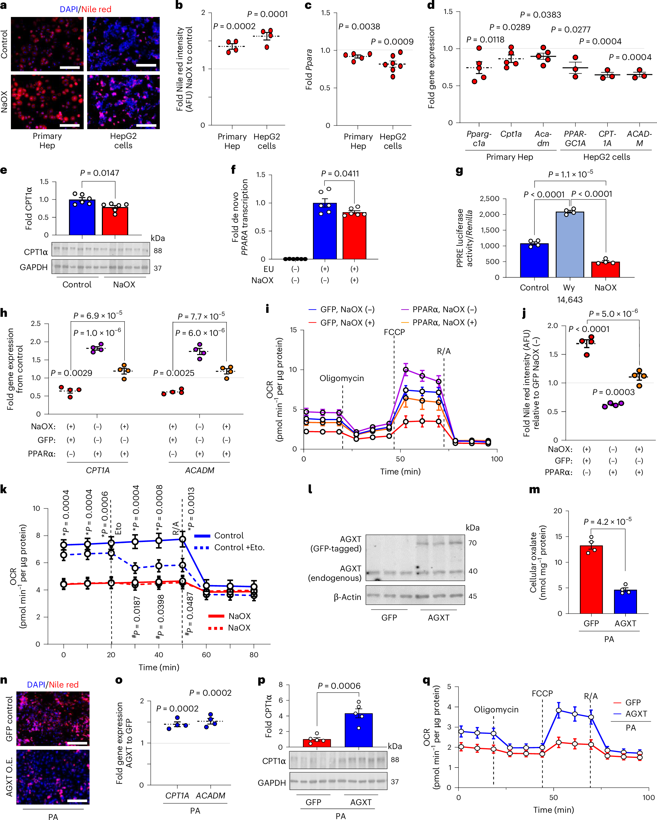 Fig. 4: Oxalate induces lipid accumulation in hepatocytes by suppressing PPARα-regulated FAO.