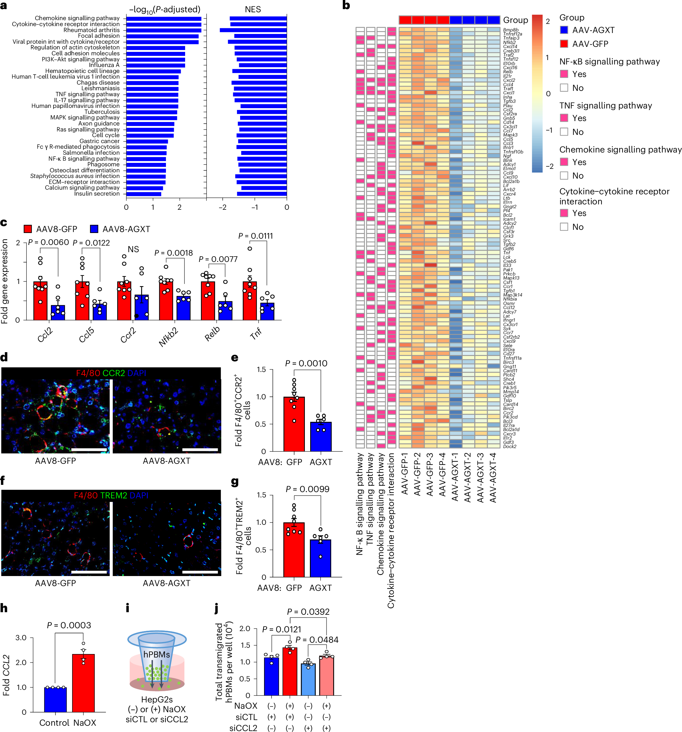 Fig. 5: Oxalate lowering via AGXT overexpression blunts monocyte infiltration and hepatic inflammation and fibrosis in MASH.