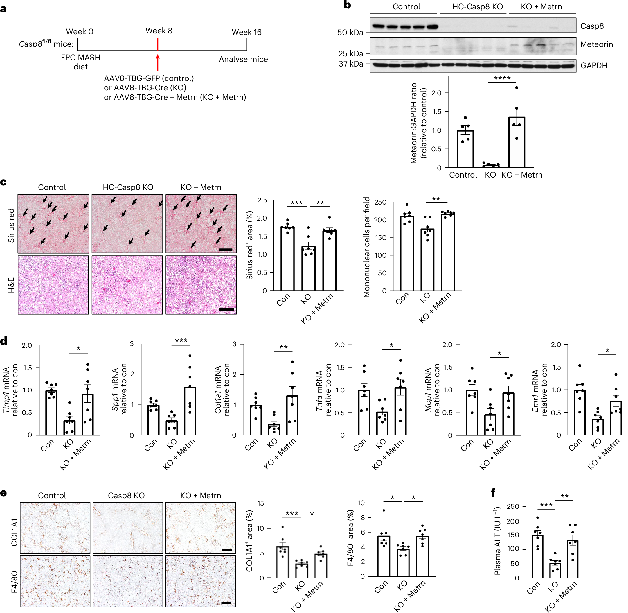 Fig. 7: Hepatocyte meteorin promotes MASH fibrosis.
