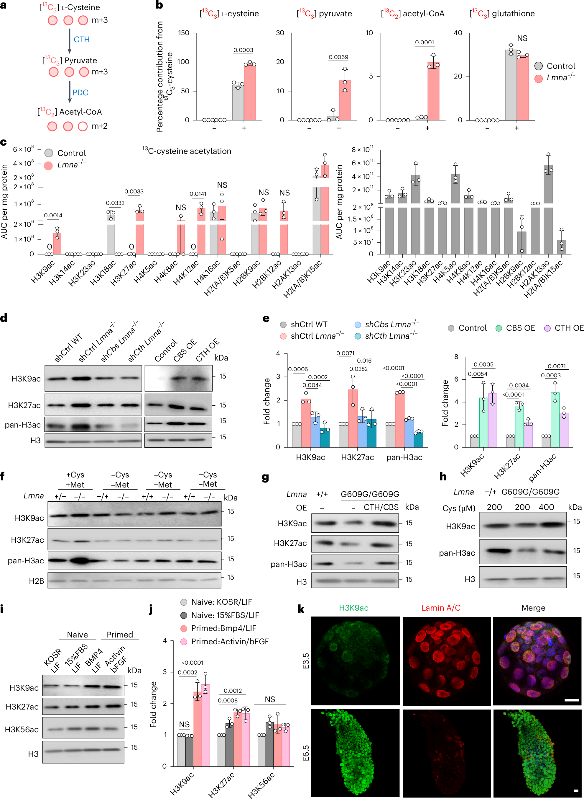 Fig. 3: Enhanced cysteine metabolism upon lamin A/C loss promotes histone acetylation.