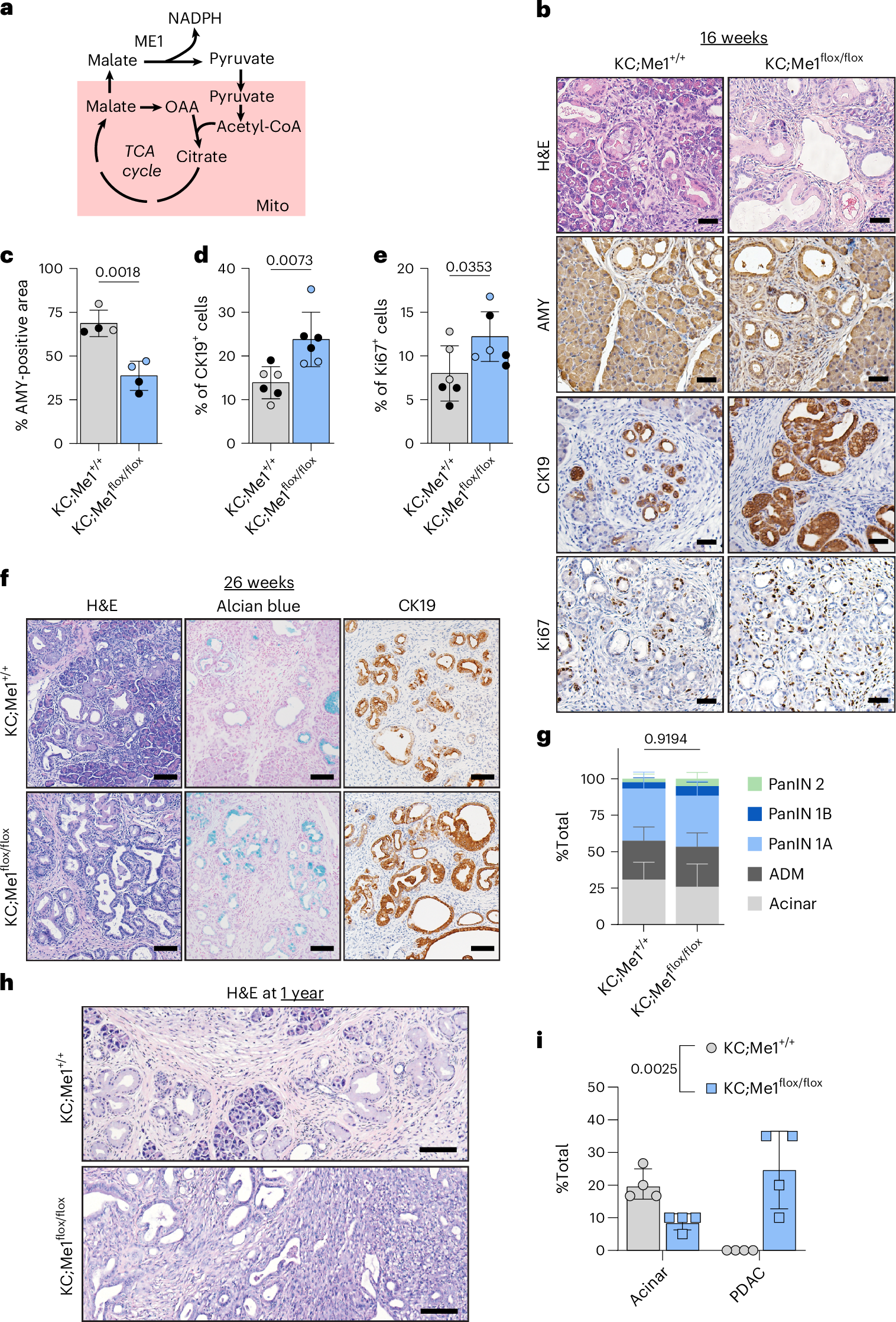 Fig. 3: Me1 loss accelerates the formation of early precursor lesions and PDAC progression.